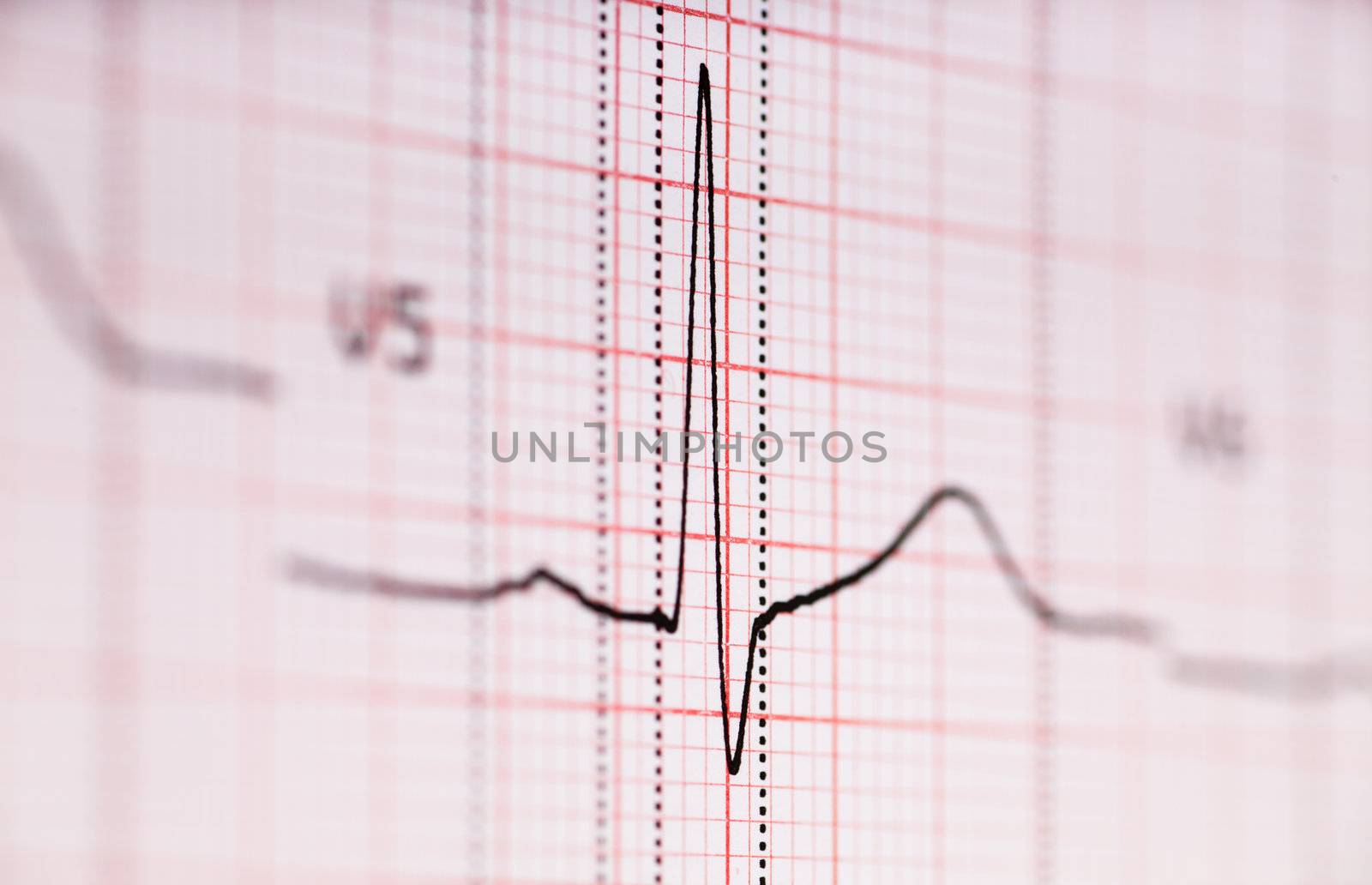 Closeup view of ECG graph. Electrocardiograph