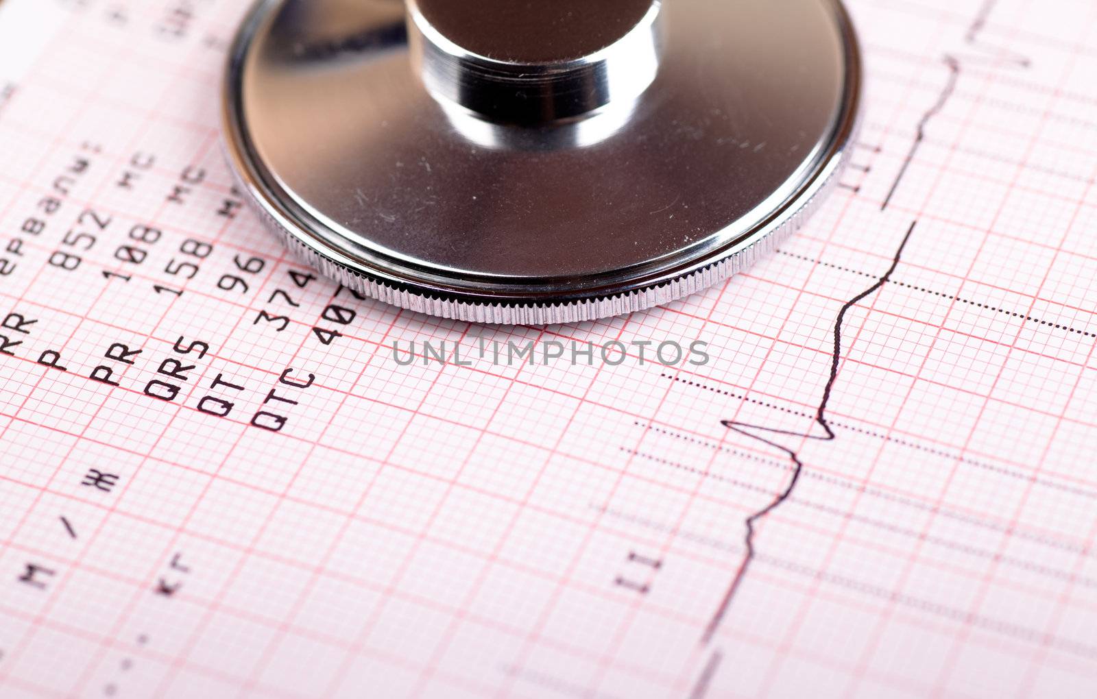 Closeup view of stethoscope on a heart analysis