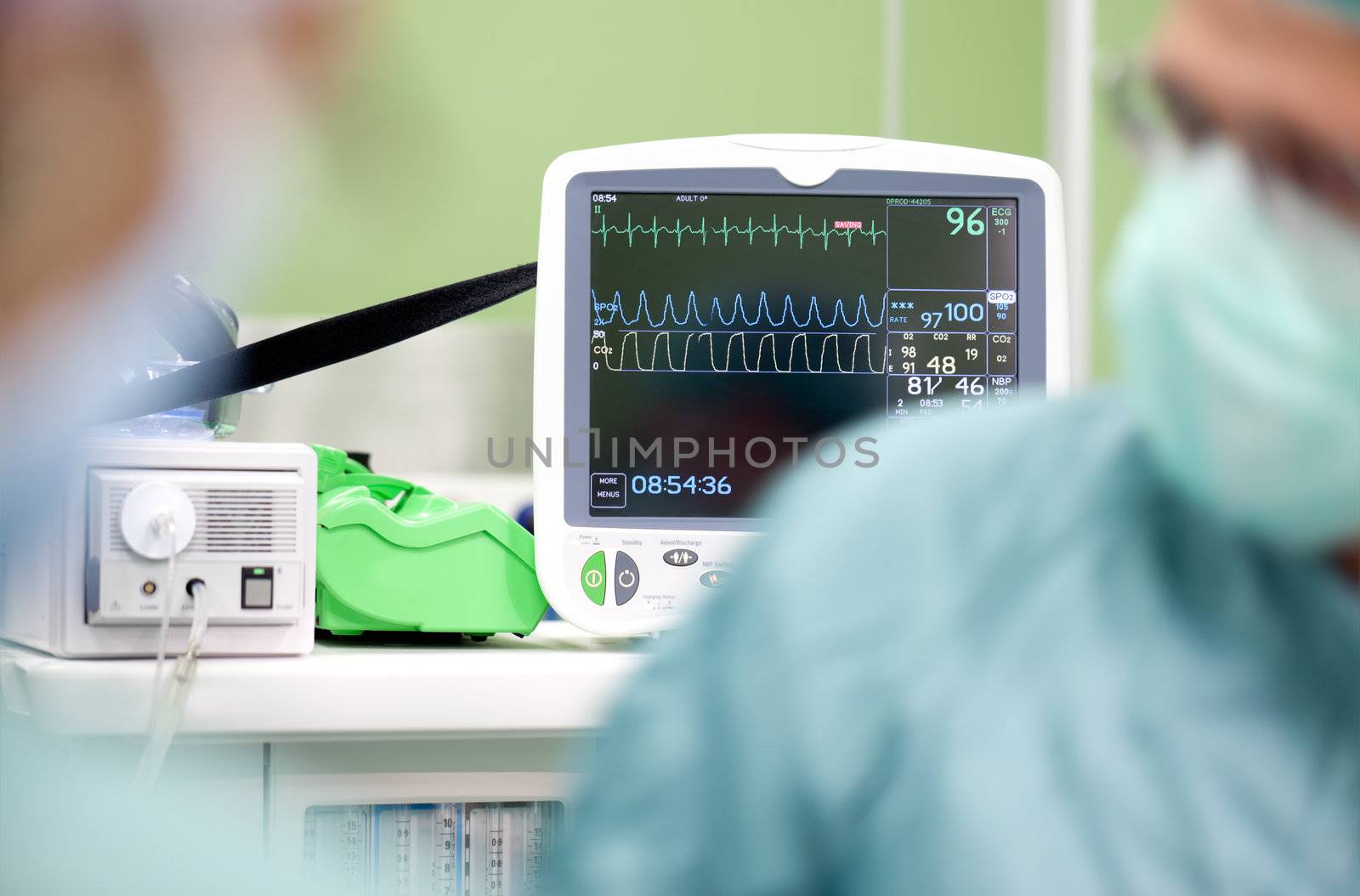 Cardiogram monitor in surgery while not recognisible doctor operates, focus on screen