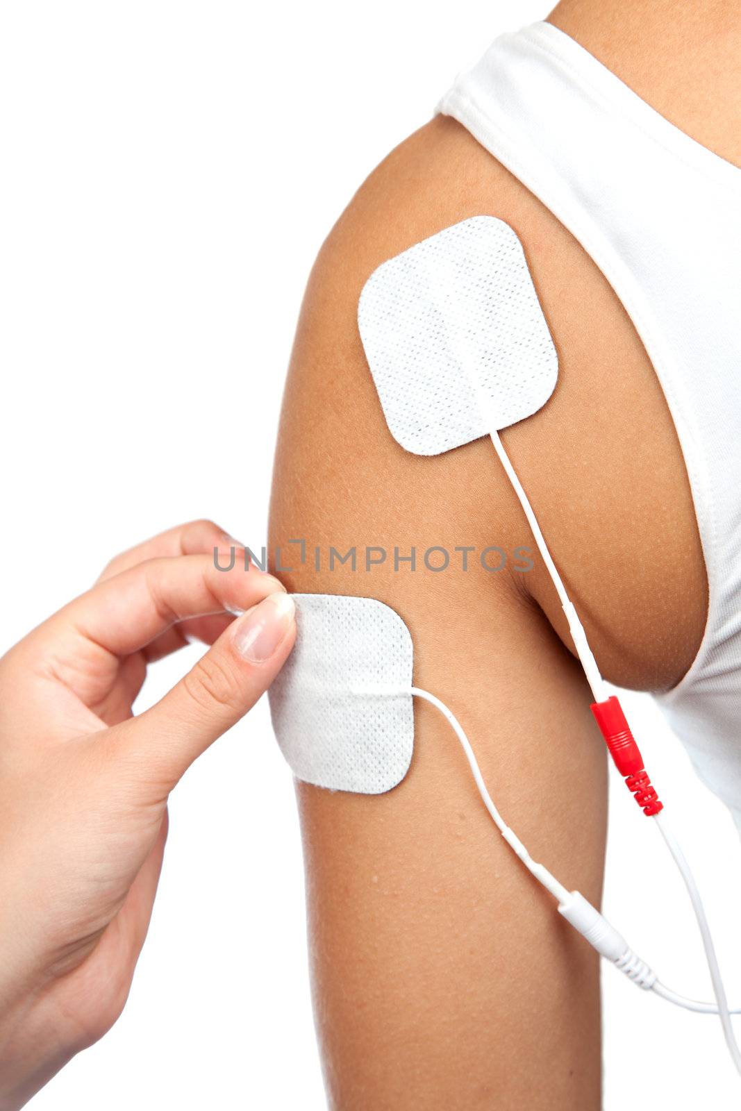 electrodes of tens device on shoulder, tens therapy, nerve stimulation
