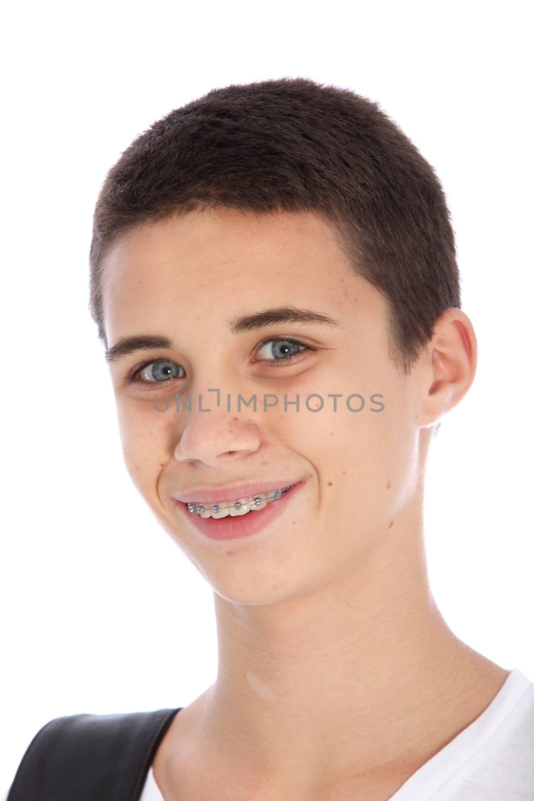 Head portrait of an attractive smiling teenage boy with orthodontic braces on his teeth to correct dental alignment isolated on white