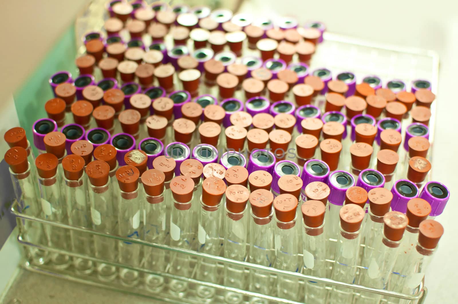  many test tubes for blood  test