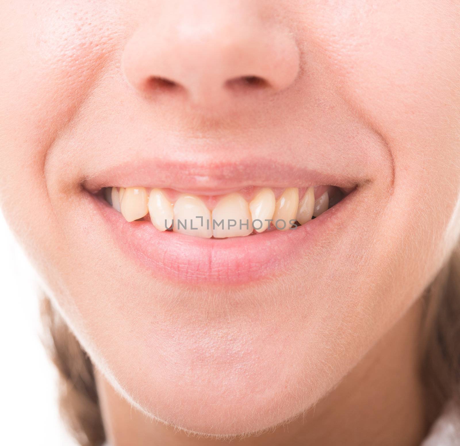 bad crooked teeth, female mouth closeup