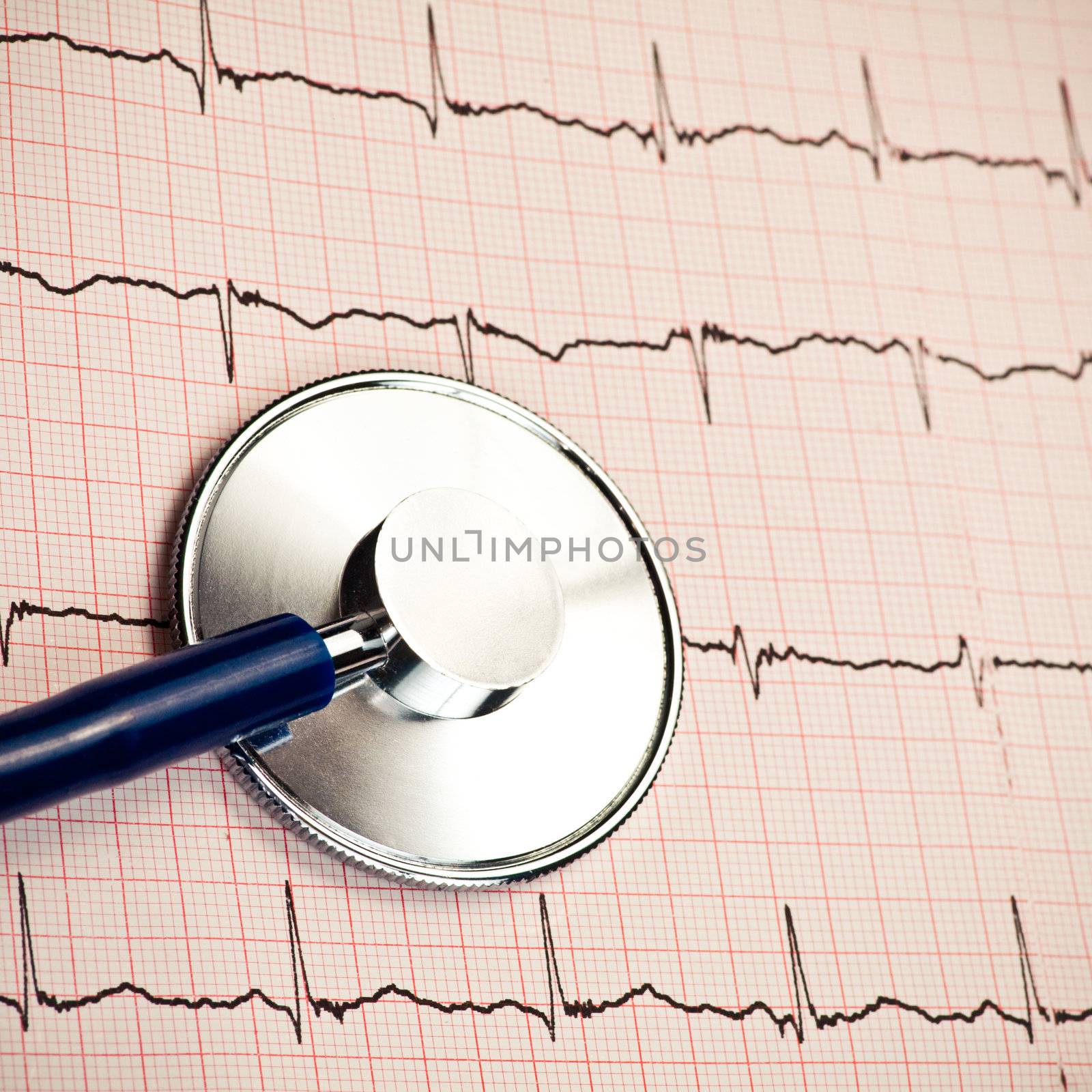 Stethoscope lying on ECG diagram