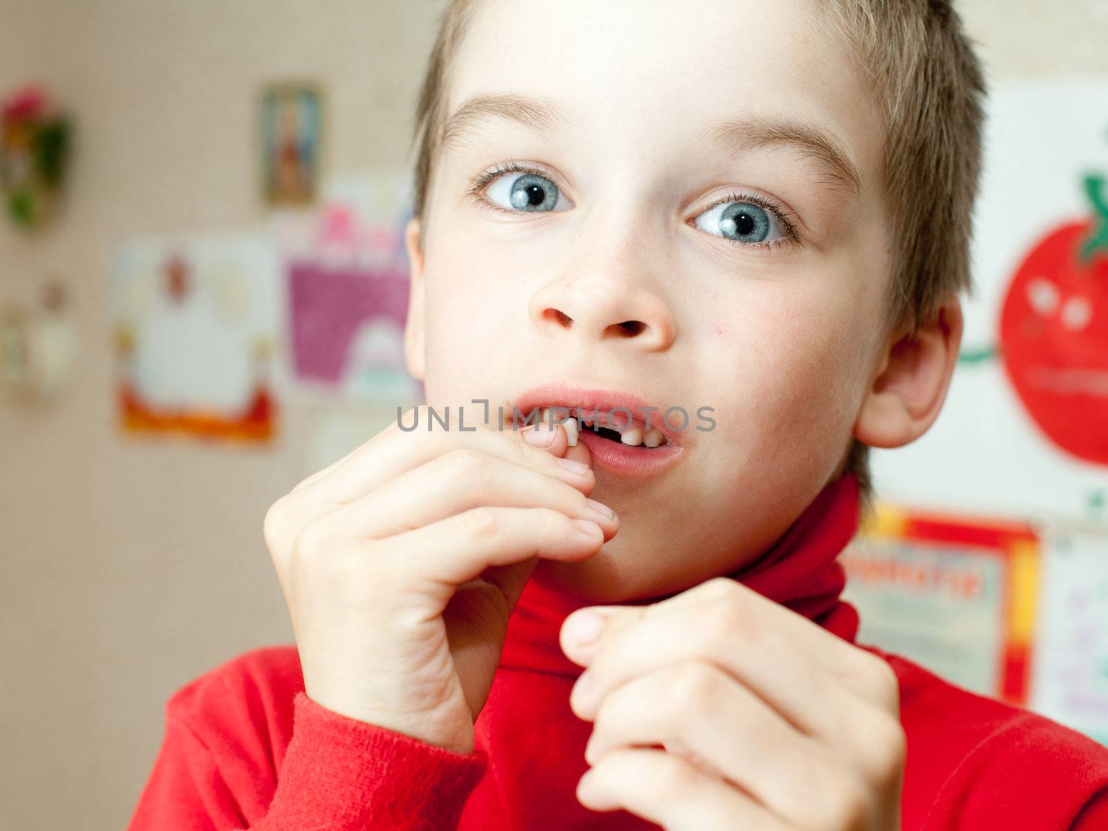 Boy holding missing teeth by naumoid