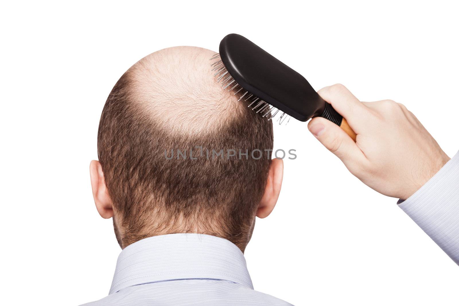 Human alopecia or hair loss - adult man hand holding comb on bald head