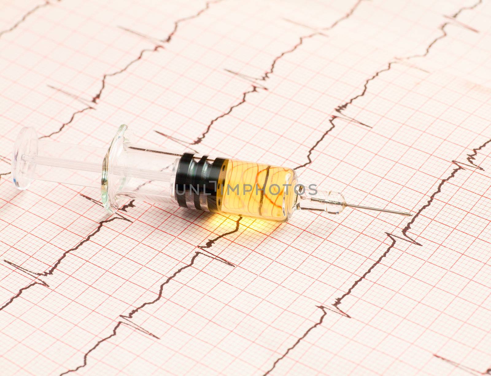 Syringe with yellow fluid on ECG diagram