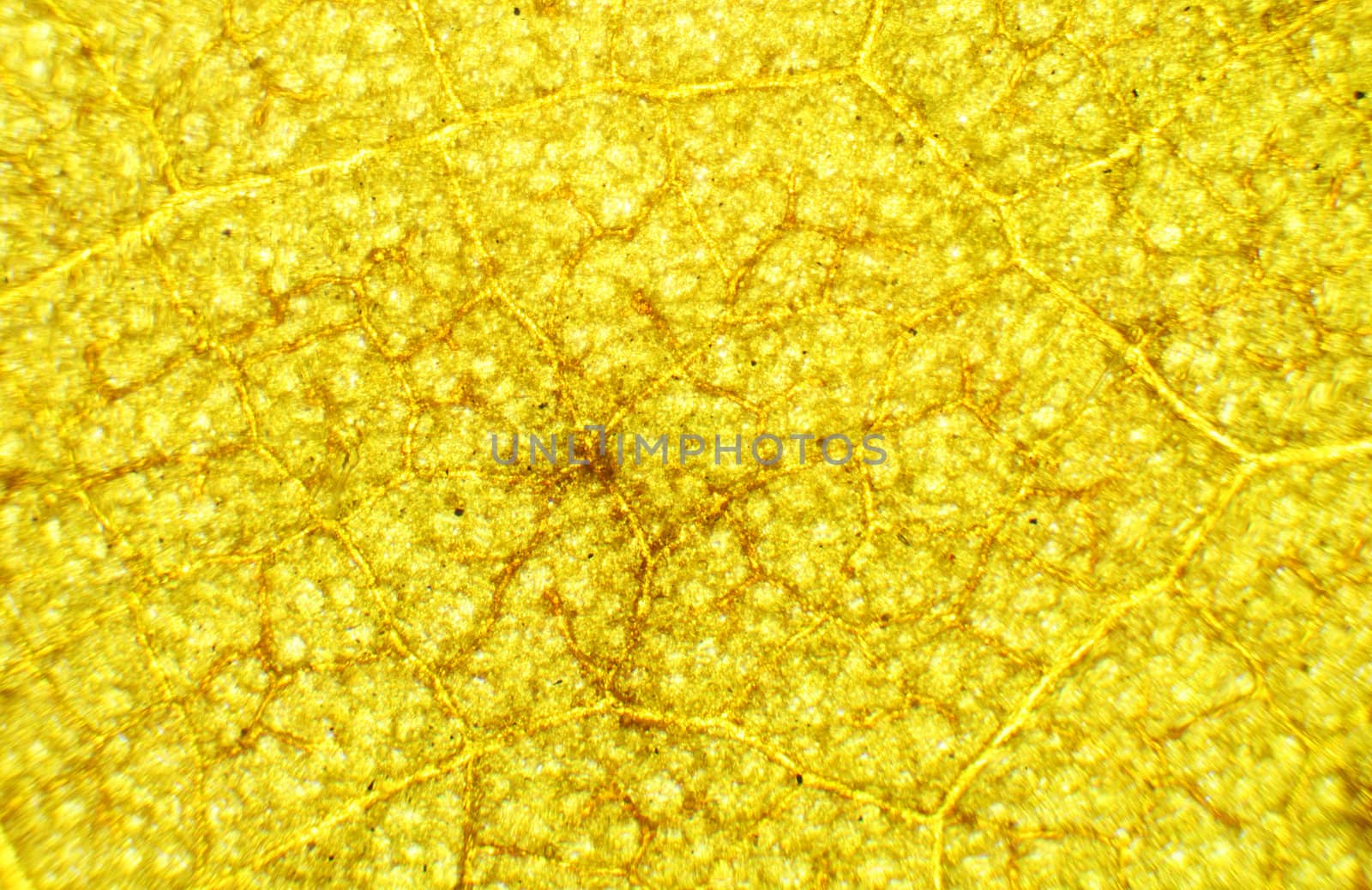Hibiscus needles under the microscope, background. (Hibiscus)