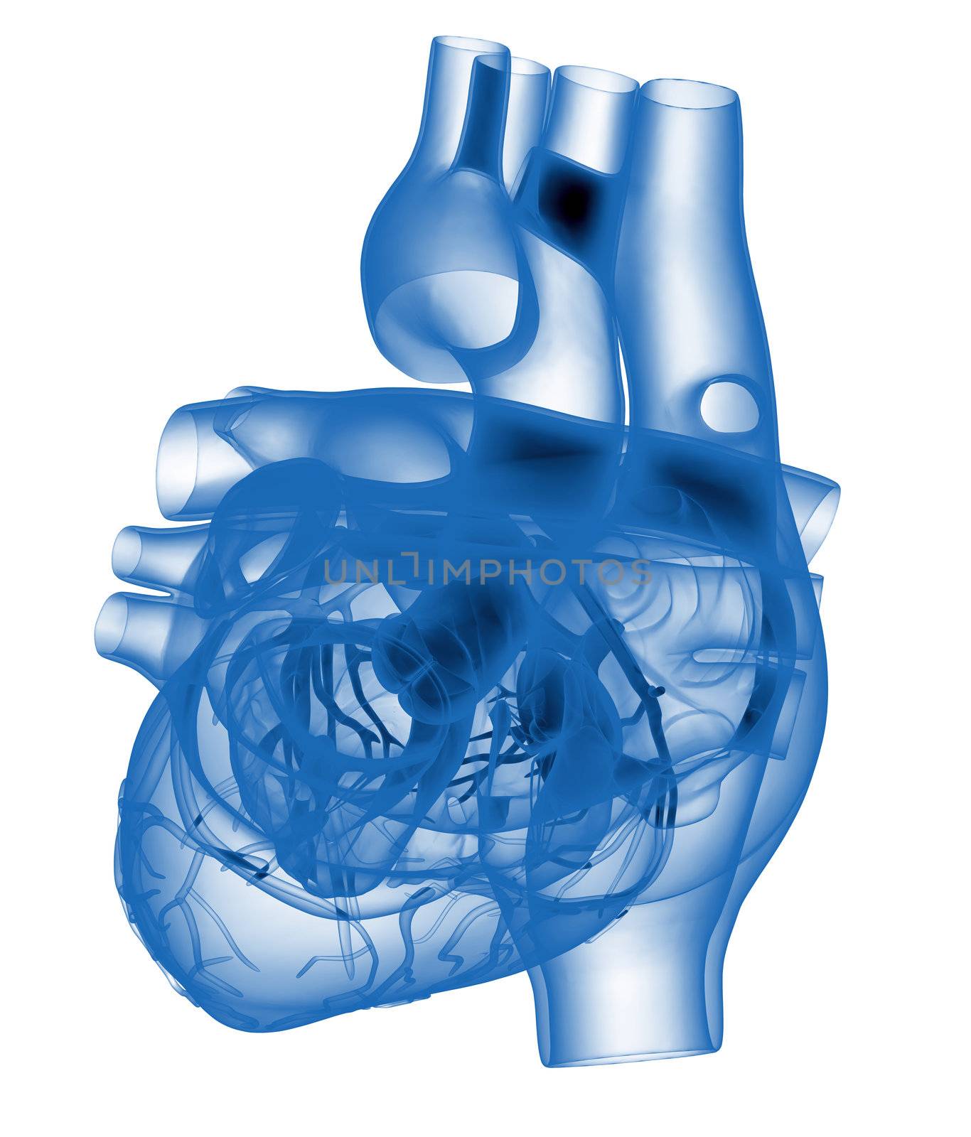 Model of artificial human heart - x-rayed
