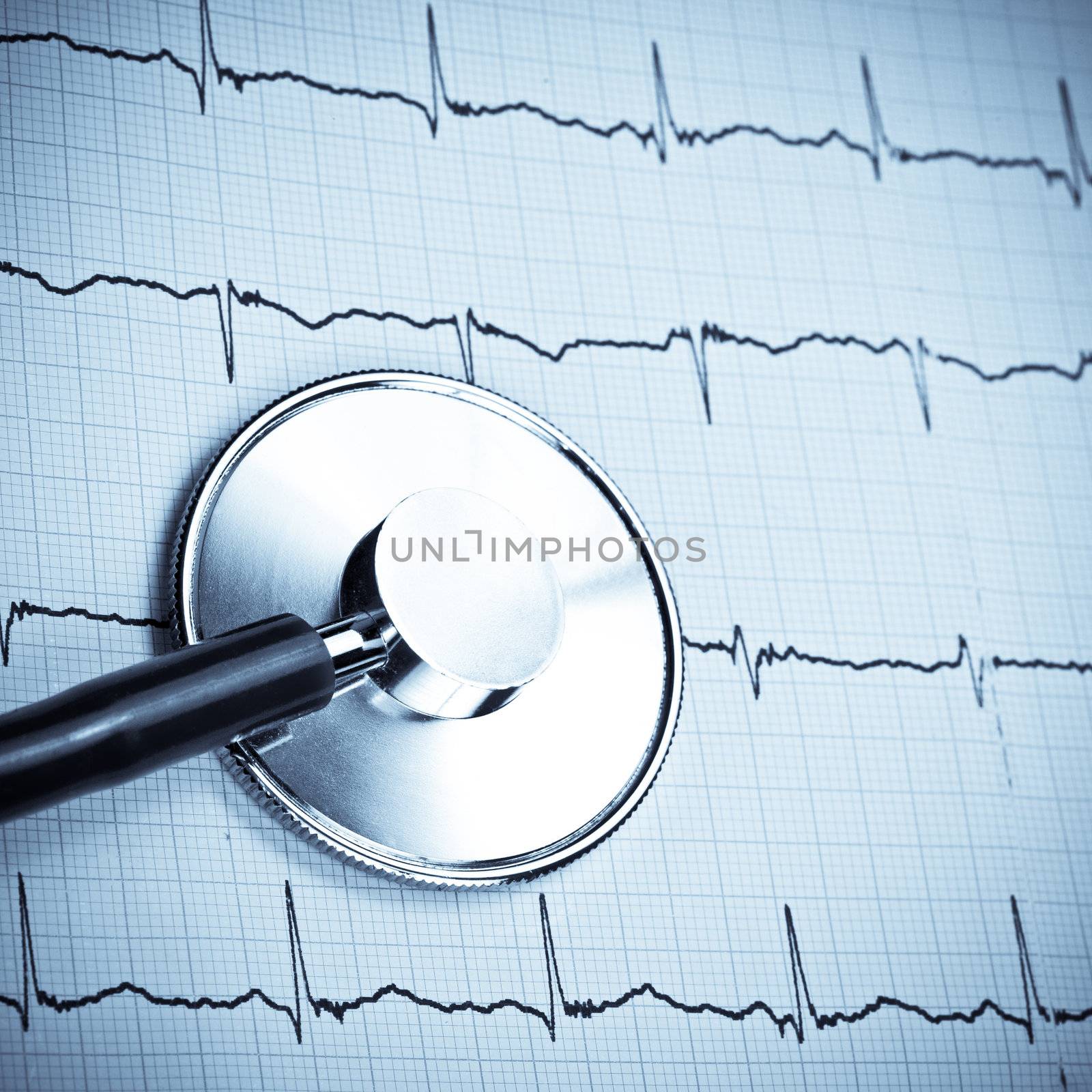 Stethoscope lying on ECG diagram