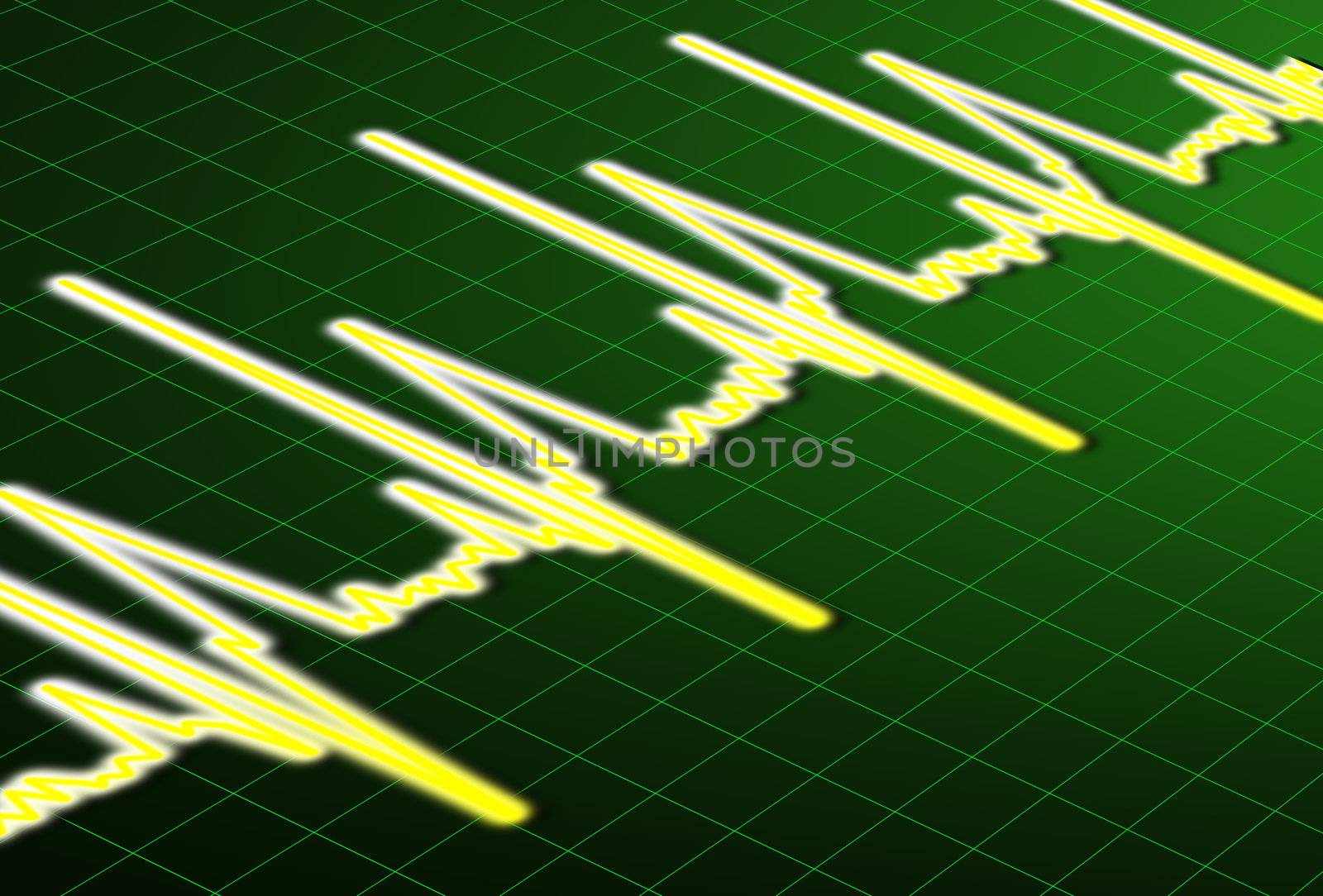 ECG - Heart Beat impulse line