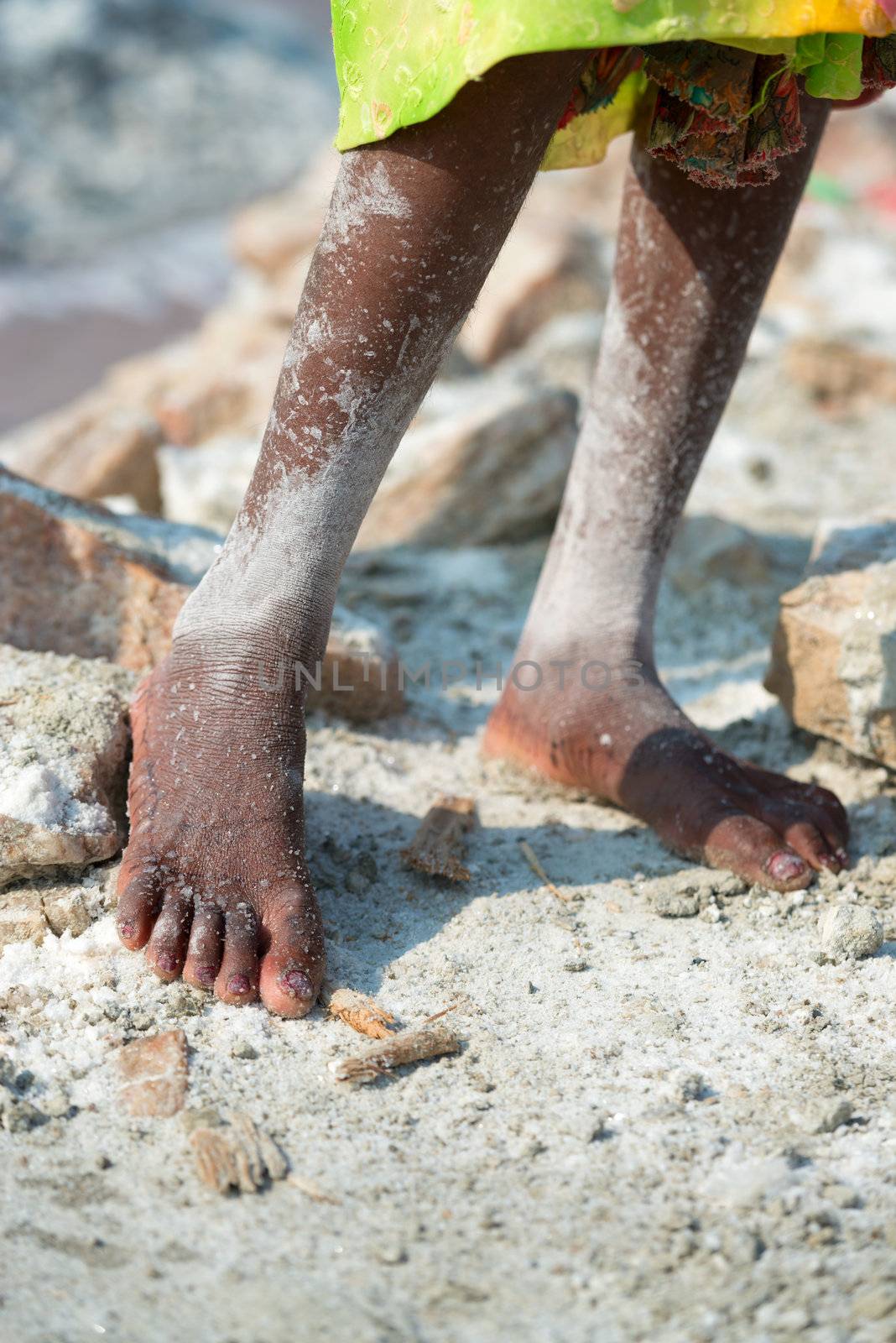 Covered by salt bare female worker's feet on salt farm on Sambhar Salt Lake, India, where salt has been farmed for a thousand years.