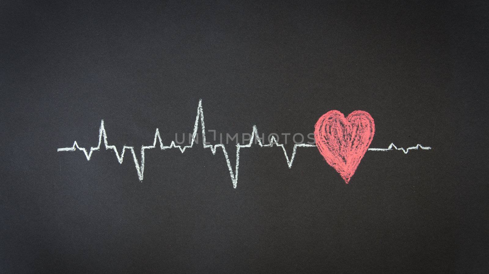 Chalk Illustration of a Heartbeat Diagram. 