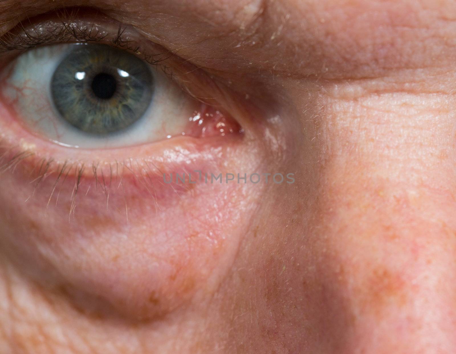 Macro close up of eye of a senior caucasian man with wrinkles and bags under eye