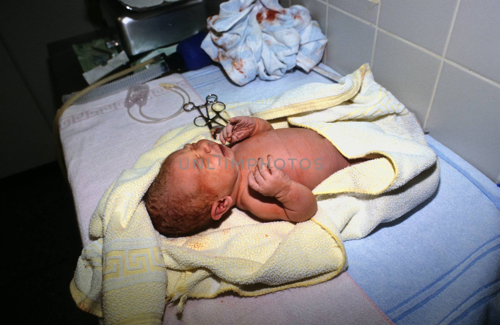 baby after birth in hospital, perinatal