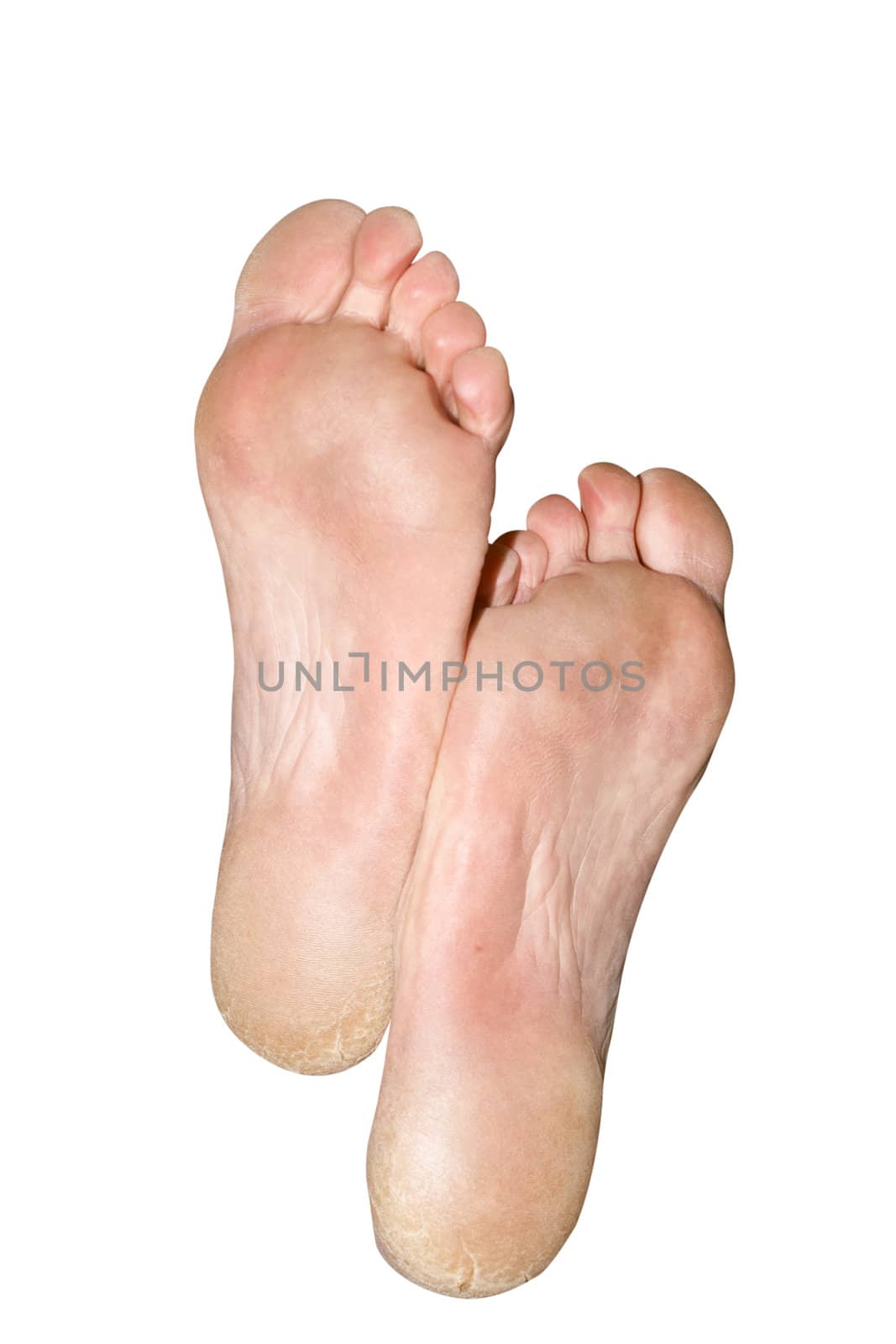 The large feet. Caucasian feet. Isolated over white background