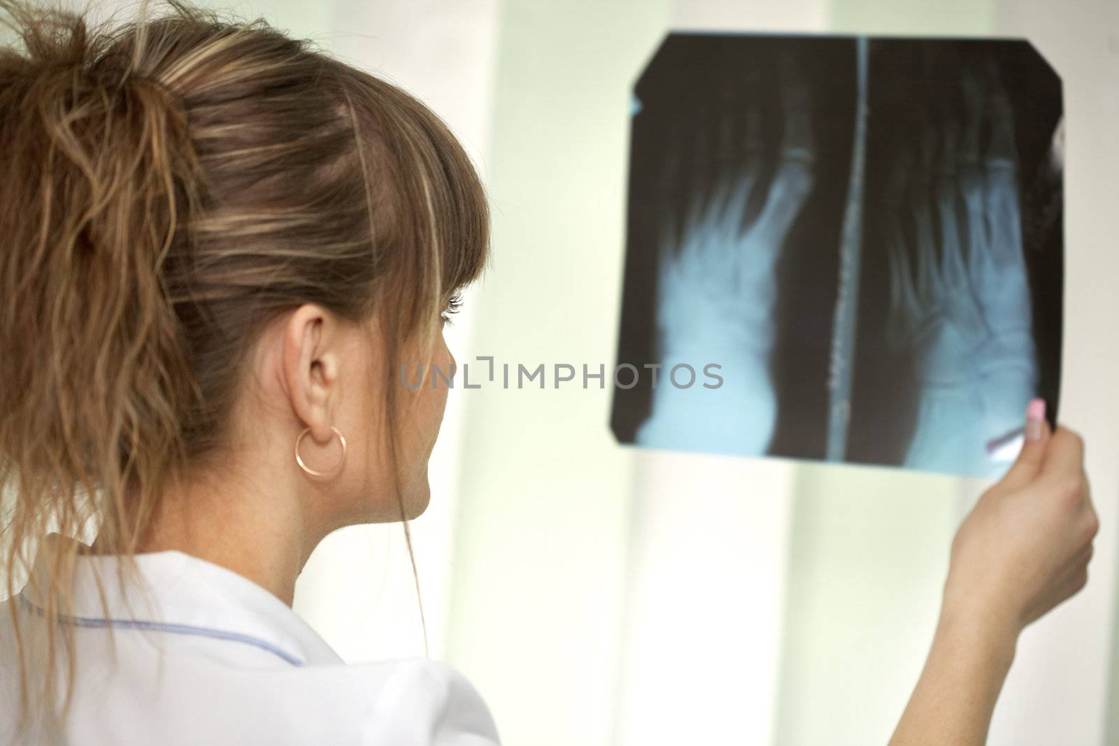 Female doctor examining an x-ray by petrkurgan