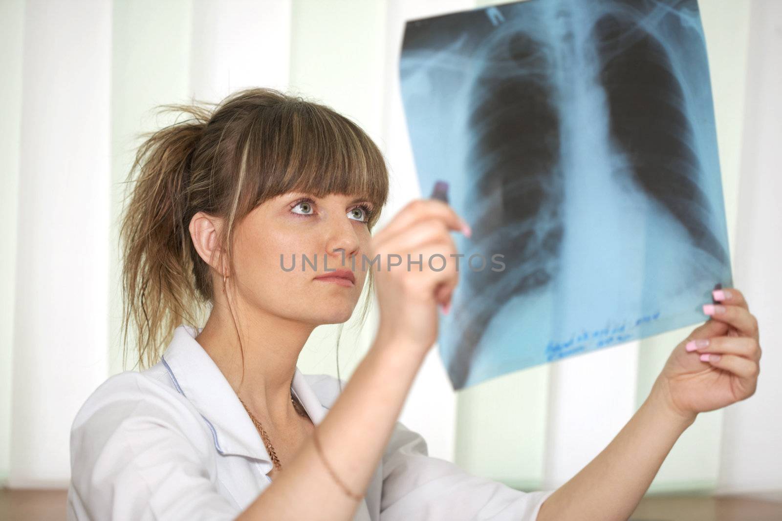 Sickness. Female doctor looking at a lungs or torso xray