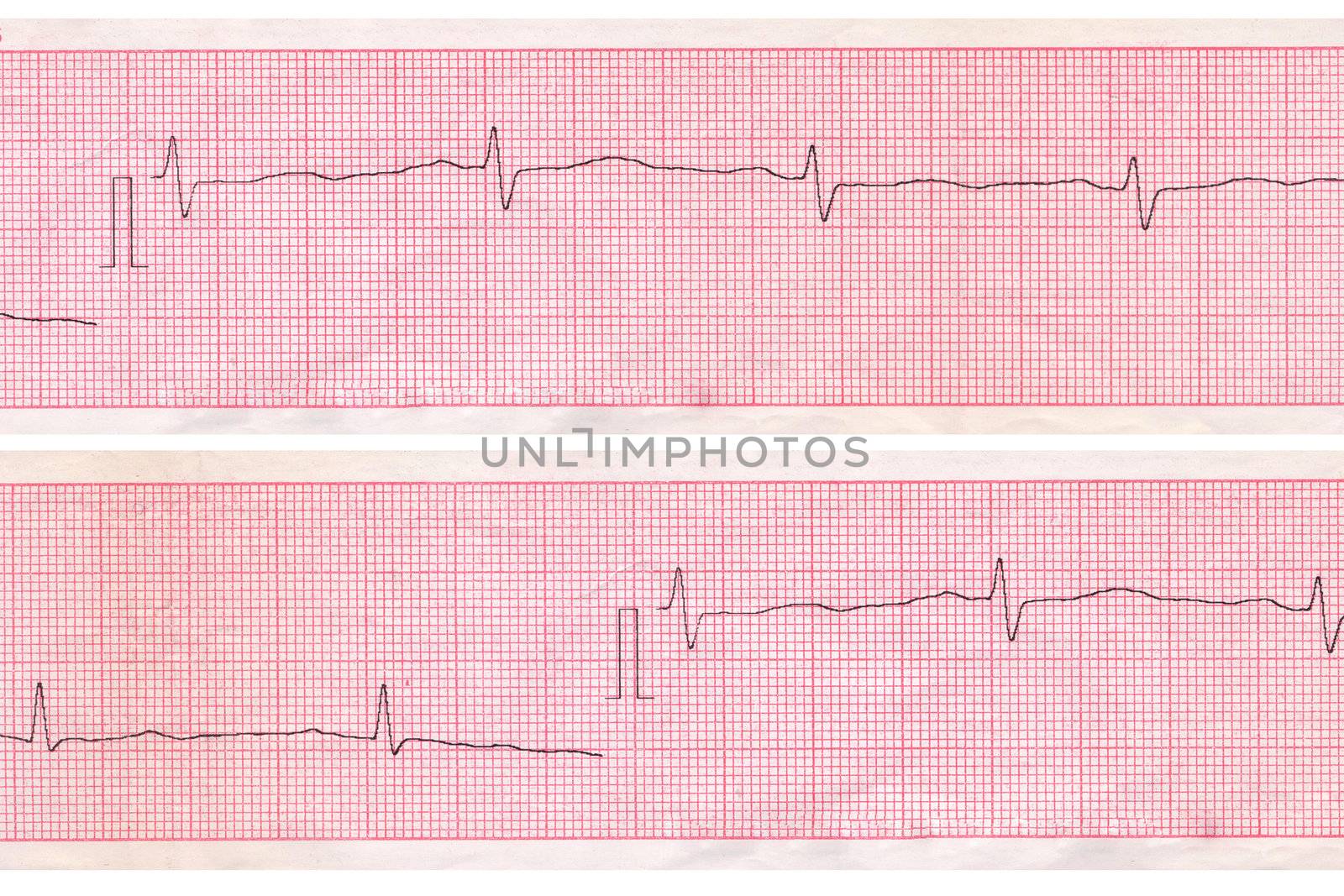 Cardiogram. Heart analysis scheme  by petrkurgan