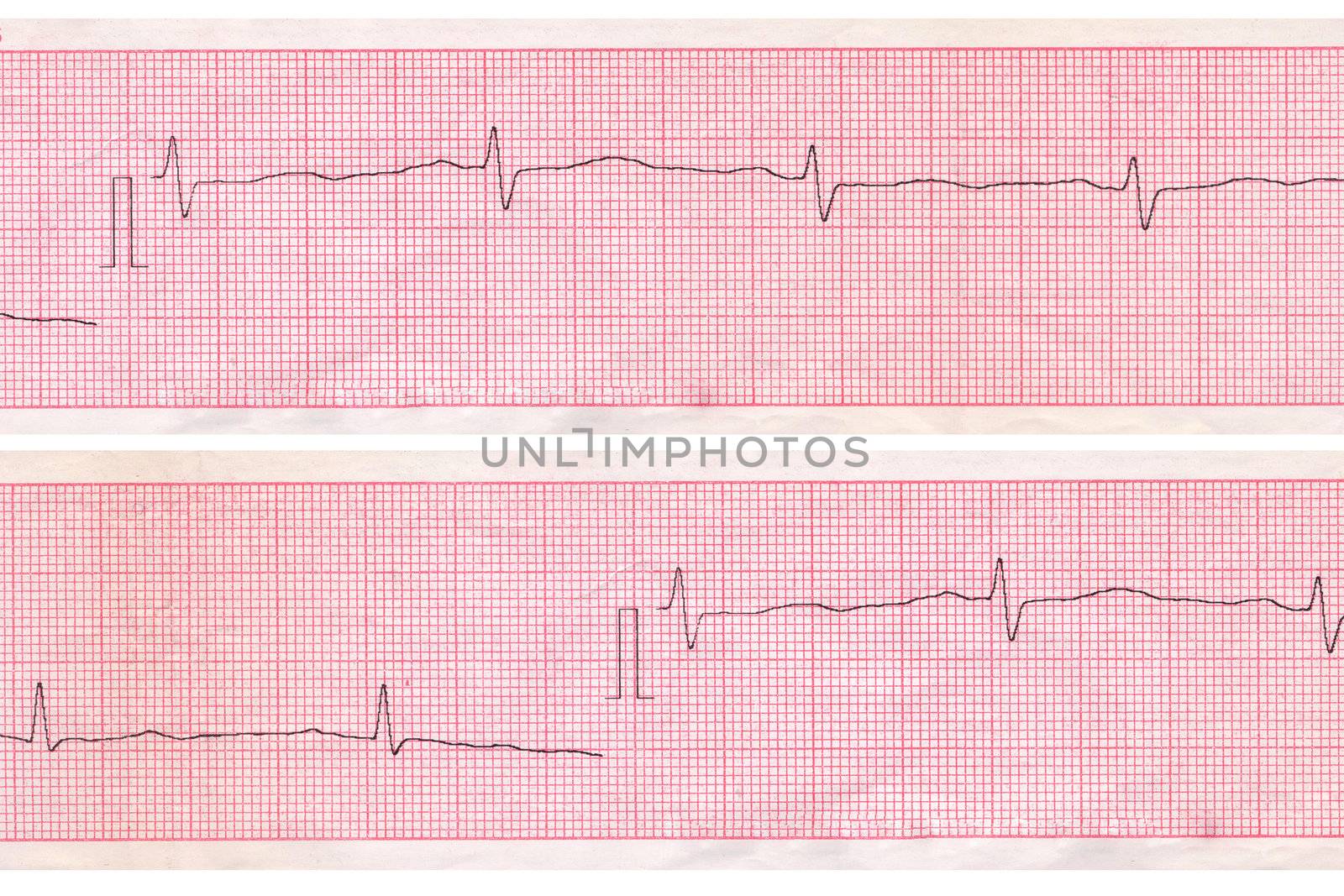 Cardiogram. Medical inspection and health. Heart analysis scheme