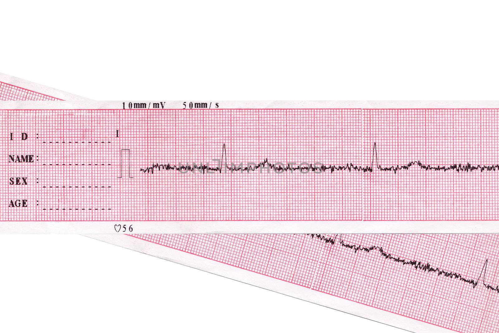 Heart. Cardiogram  by petrkurgan