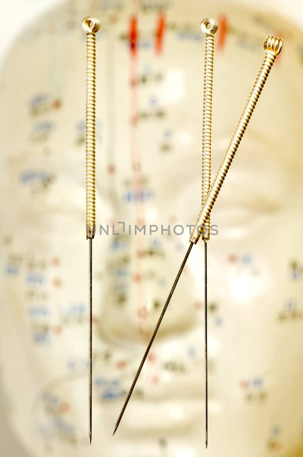 Acupuncture needles over head model by Jochen