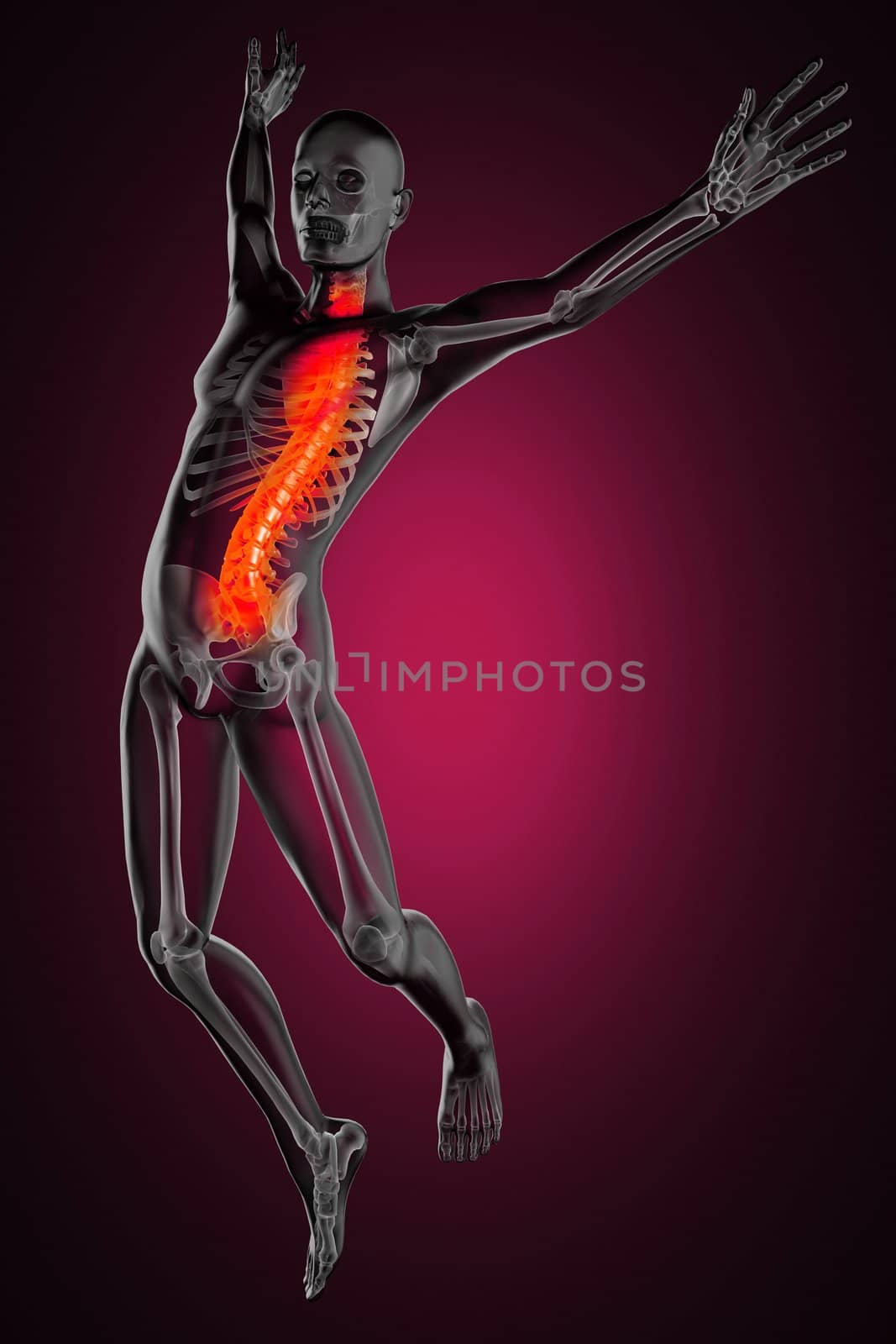 jump man radiography by videodoctor