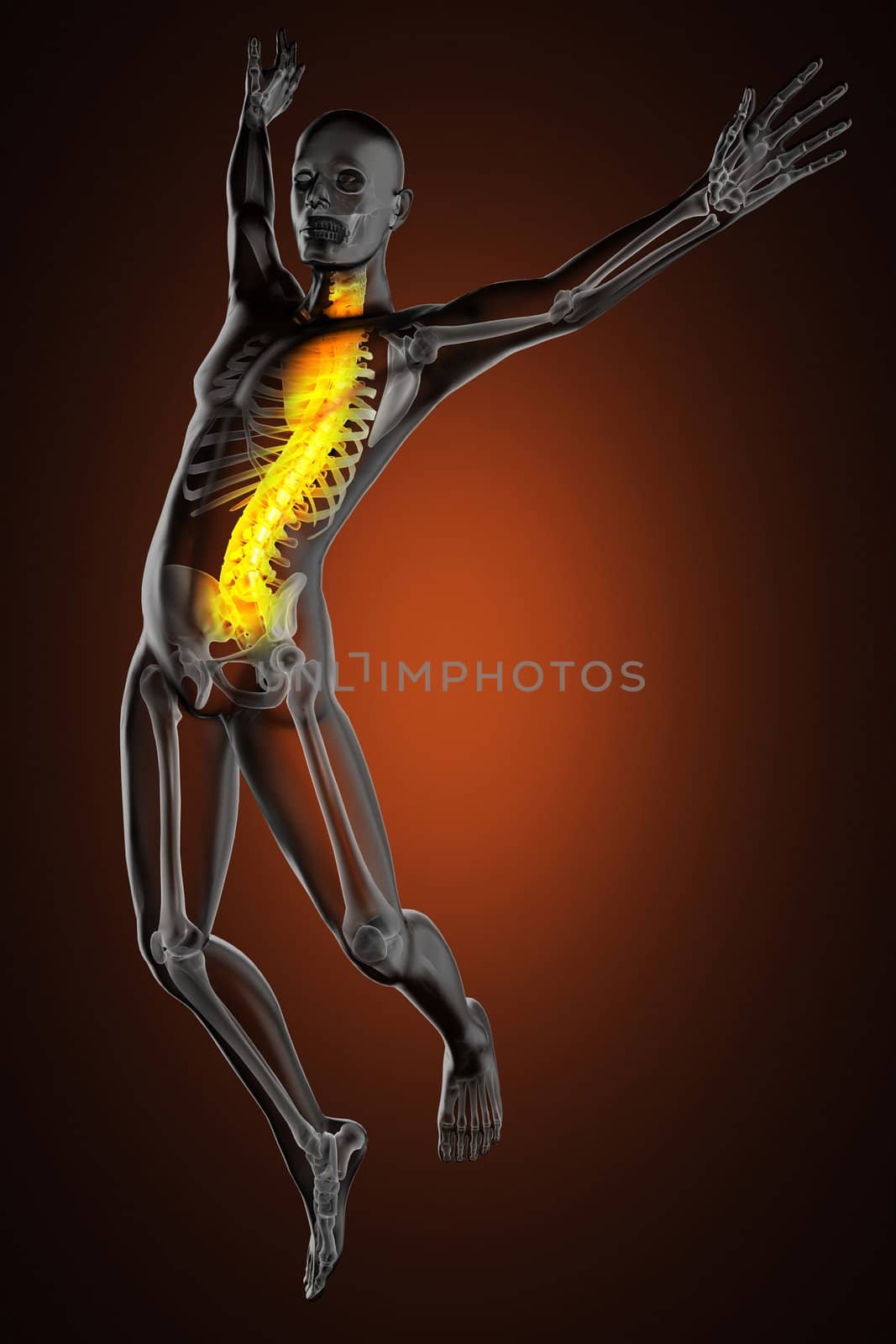 jump man radiography by videodoctor