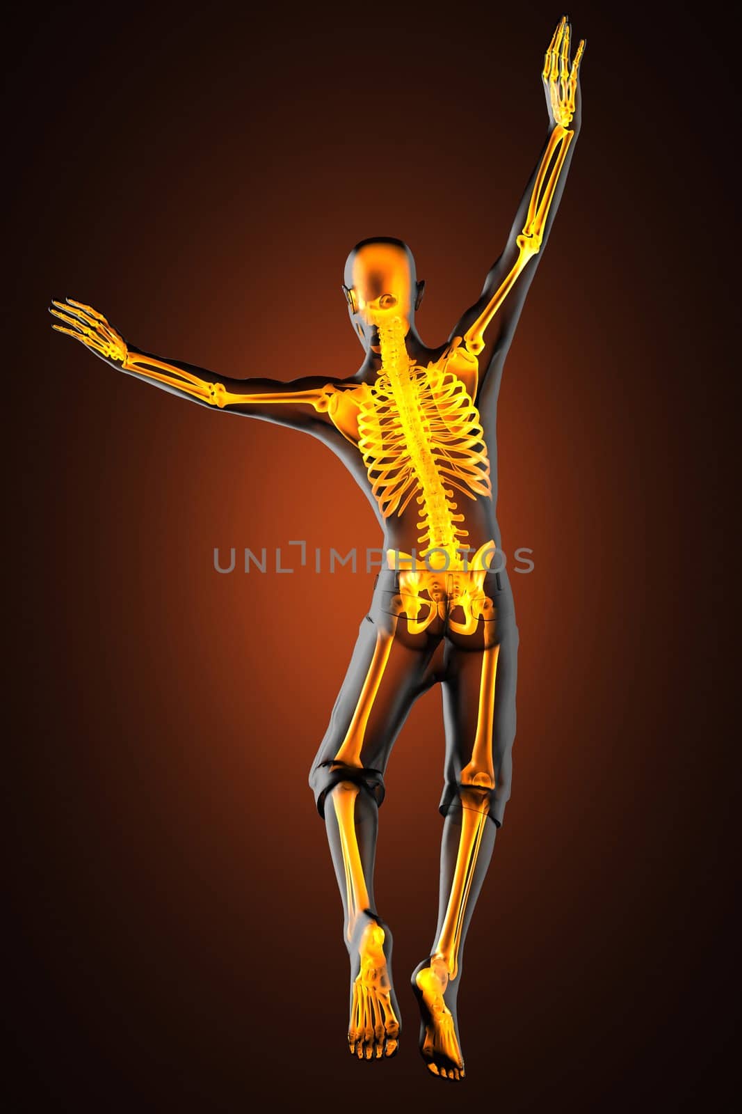 jump man radiography by videodoctor