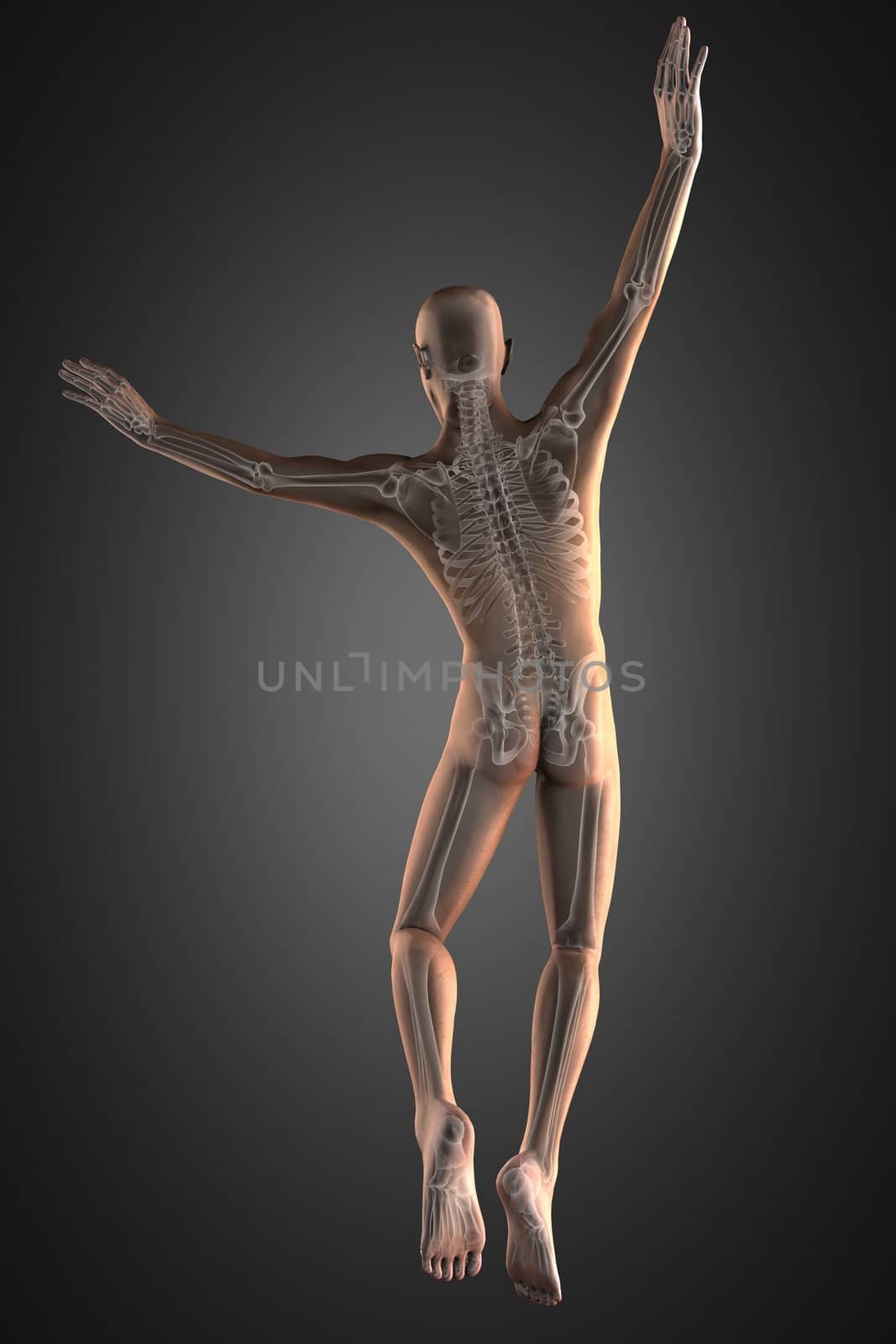 jump man radiography by videodoctor