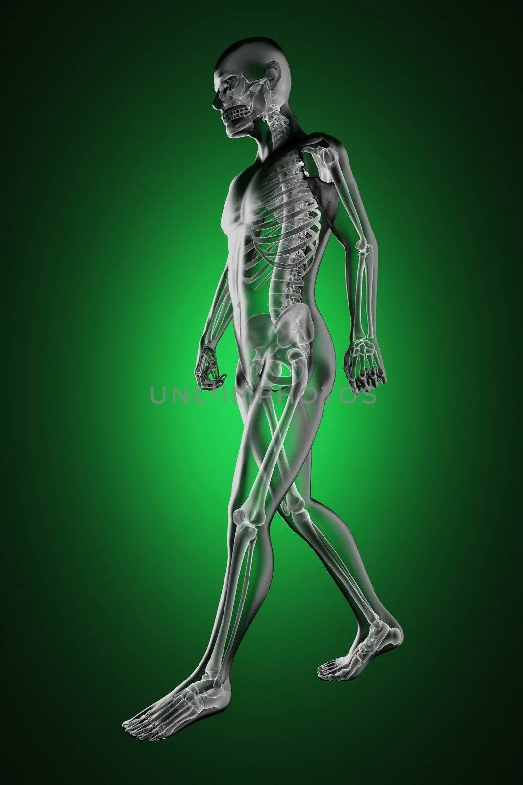 walking man radiography made in 3D