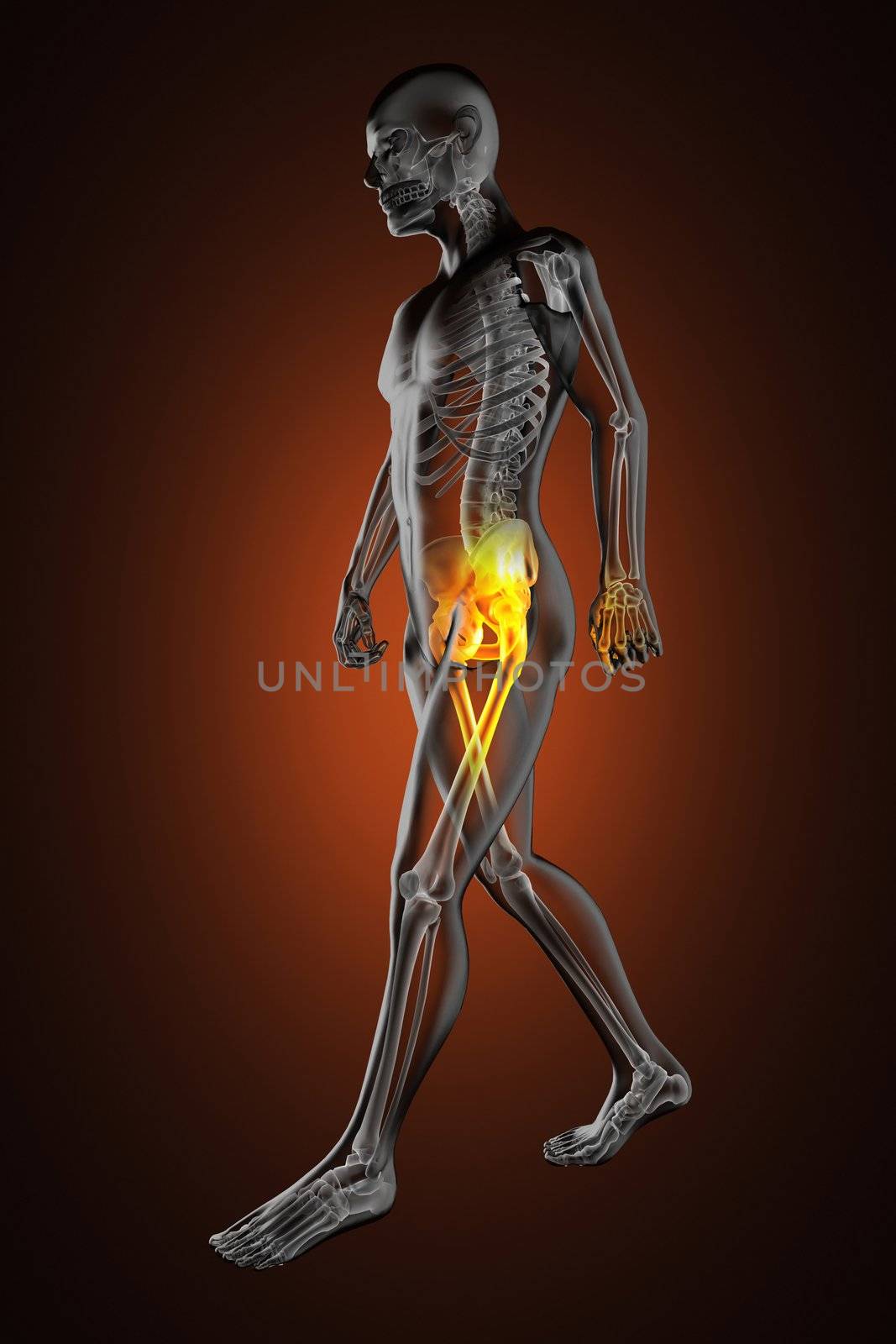 walking man radiography made in 3D