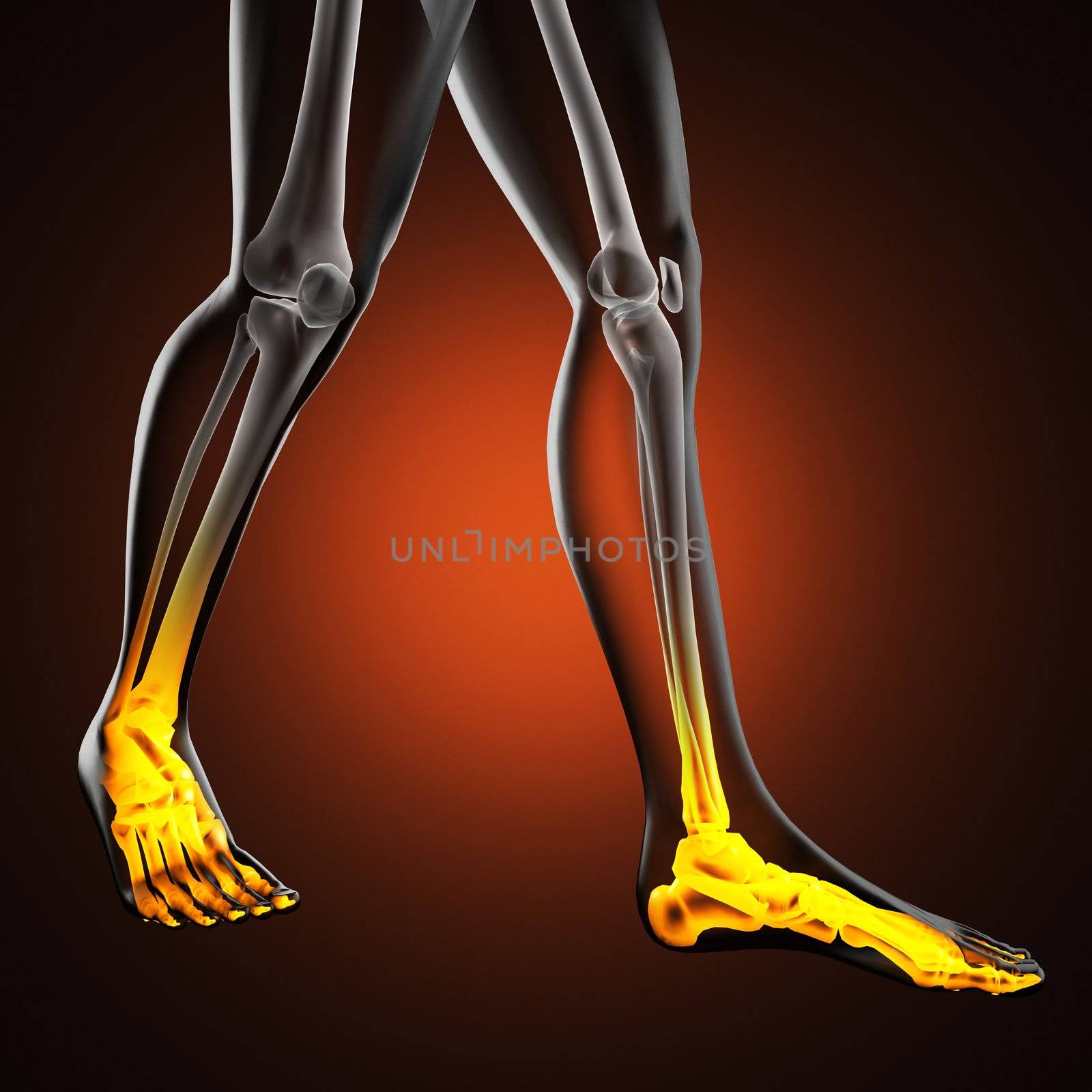 human radiography scan by videodoctor