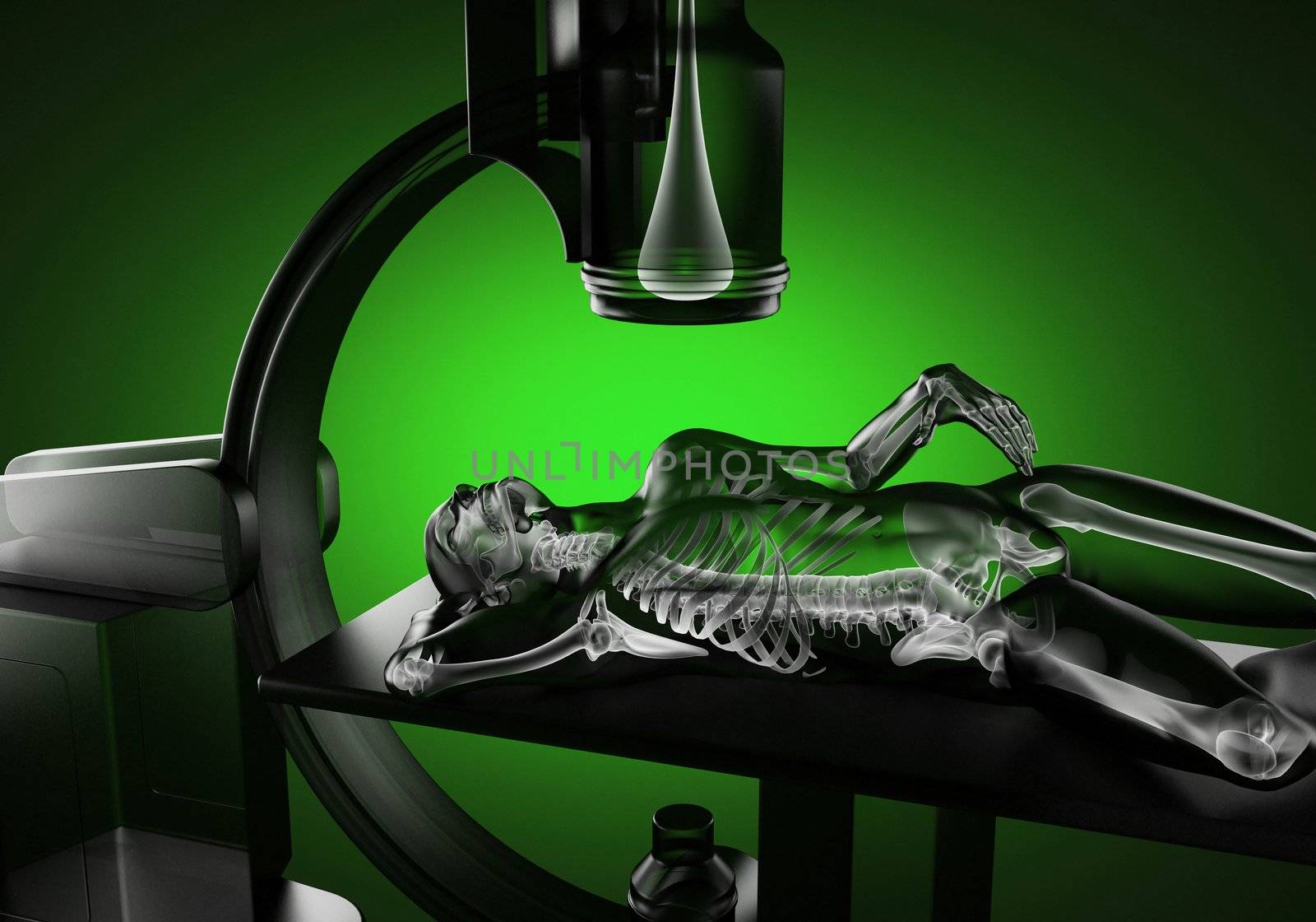 x-ray examination made in 3D graphics