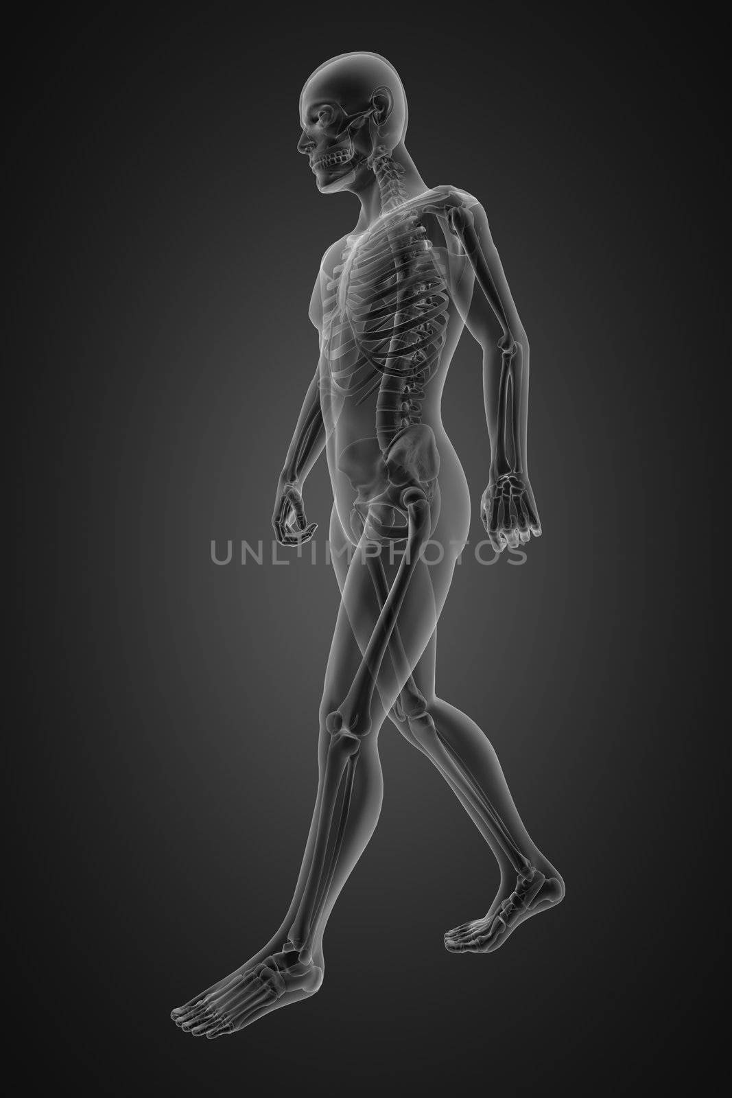 walking man radiography by videodoctor