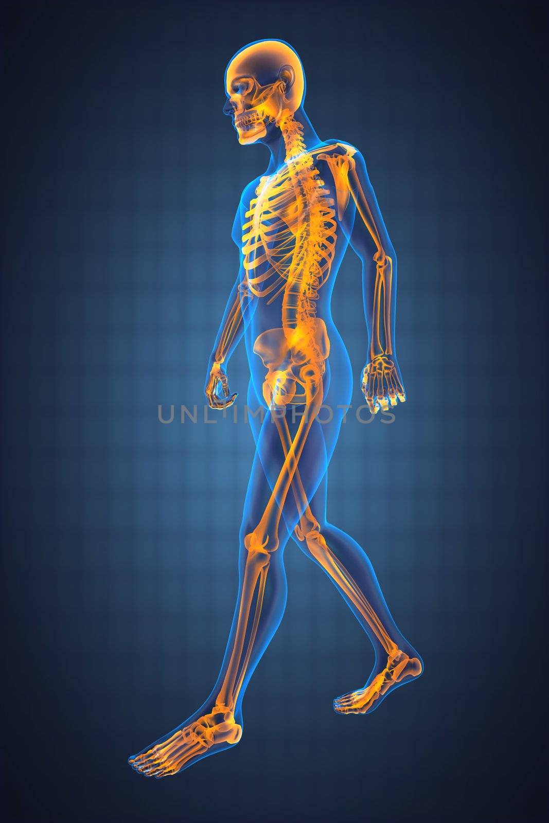 walking man radiography by videodoctor