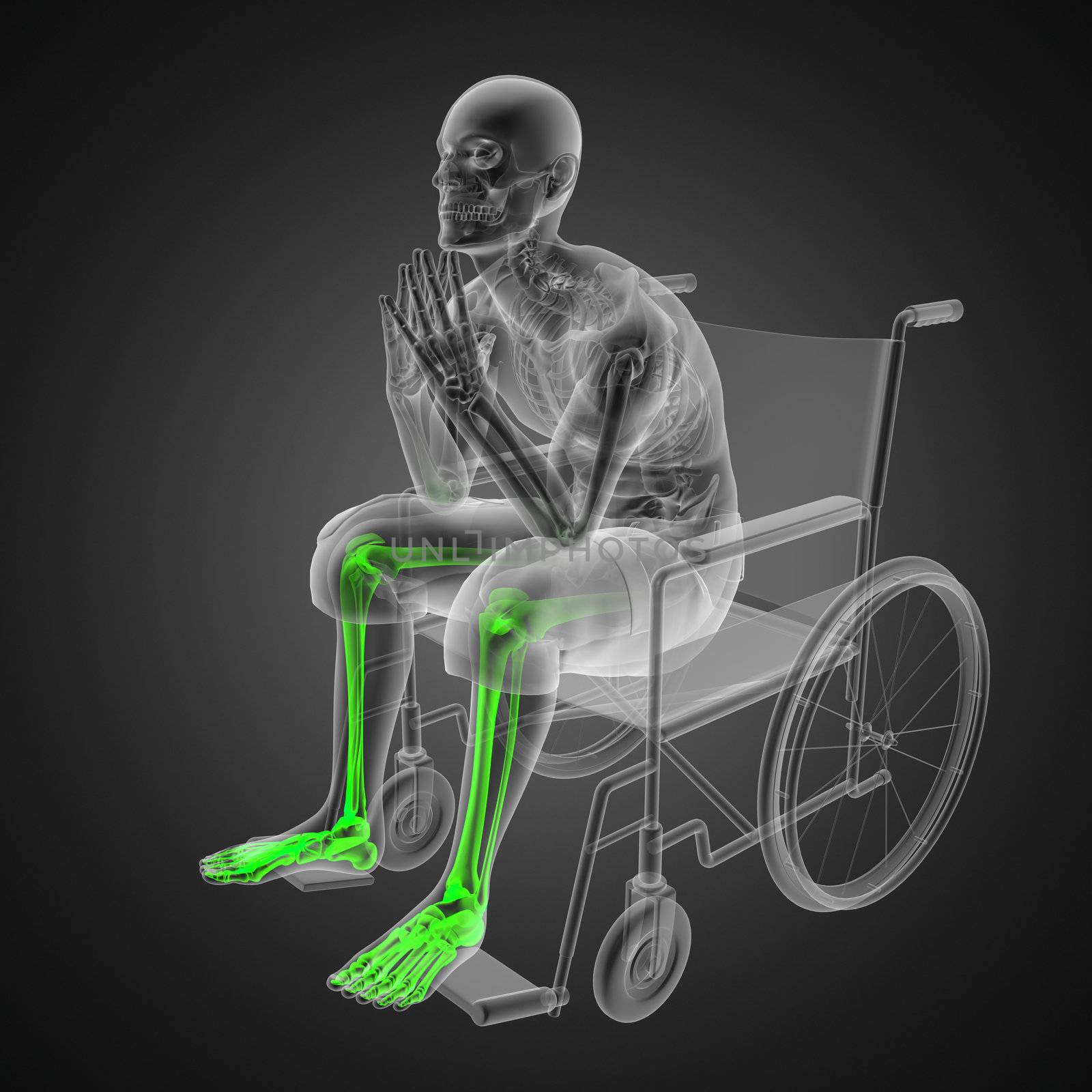 Man in wheelchair made in 3D