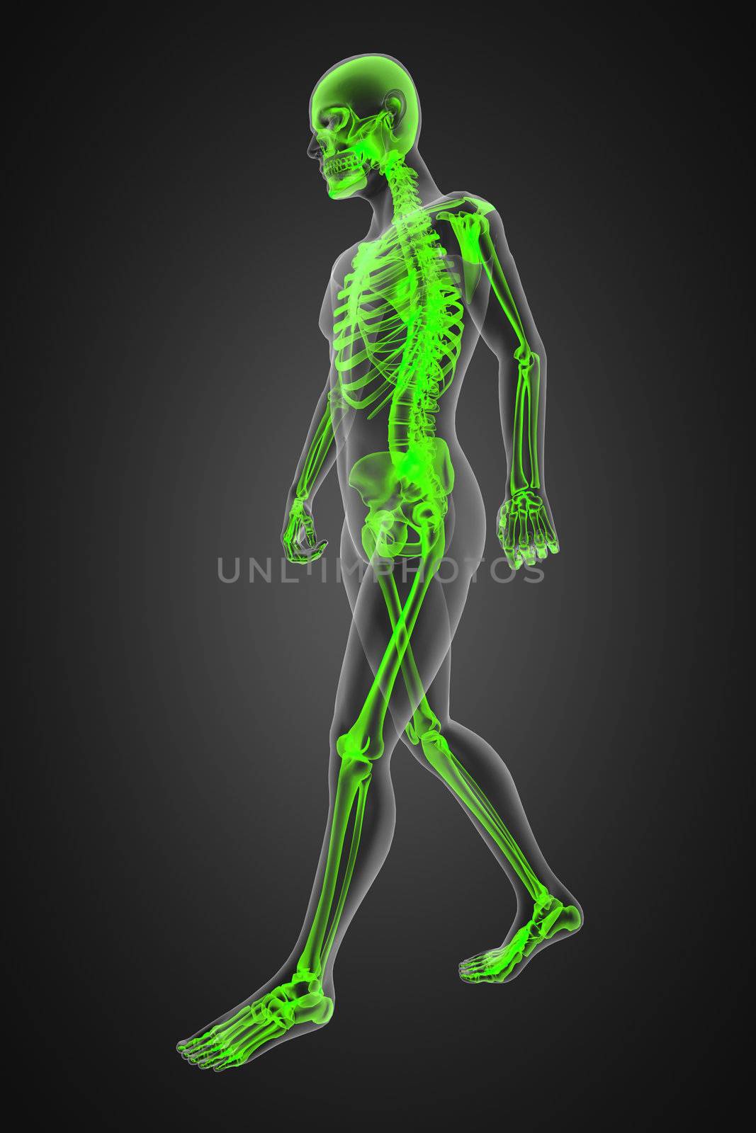 walking man radiography made in 3D