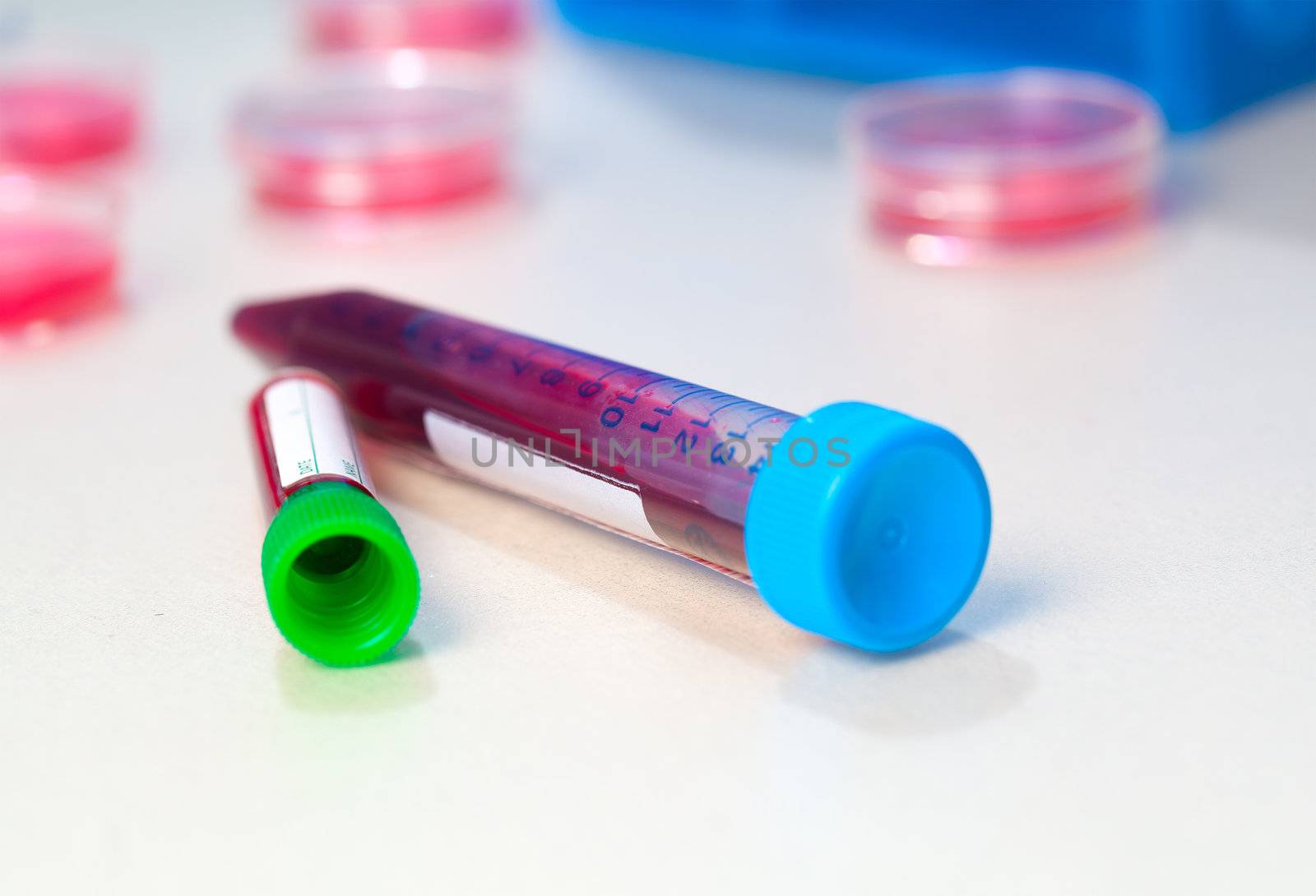 Blood In tube for laboratory analysis