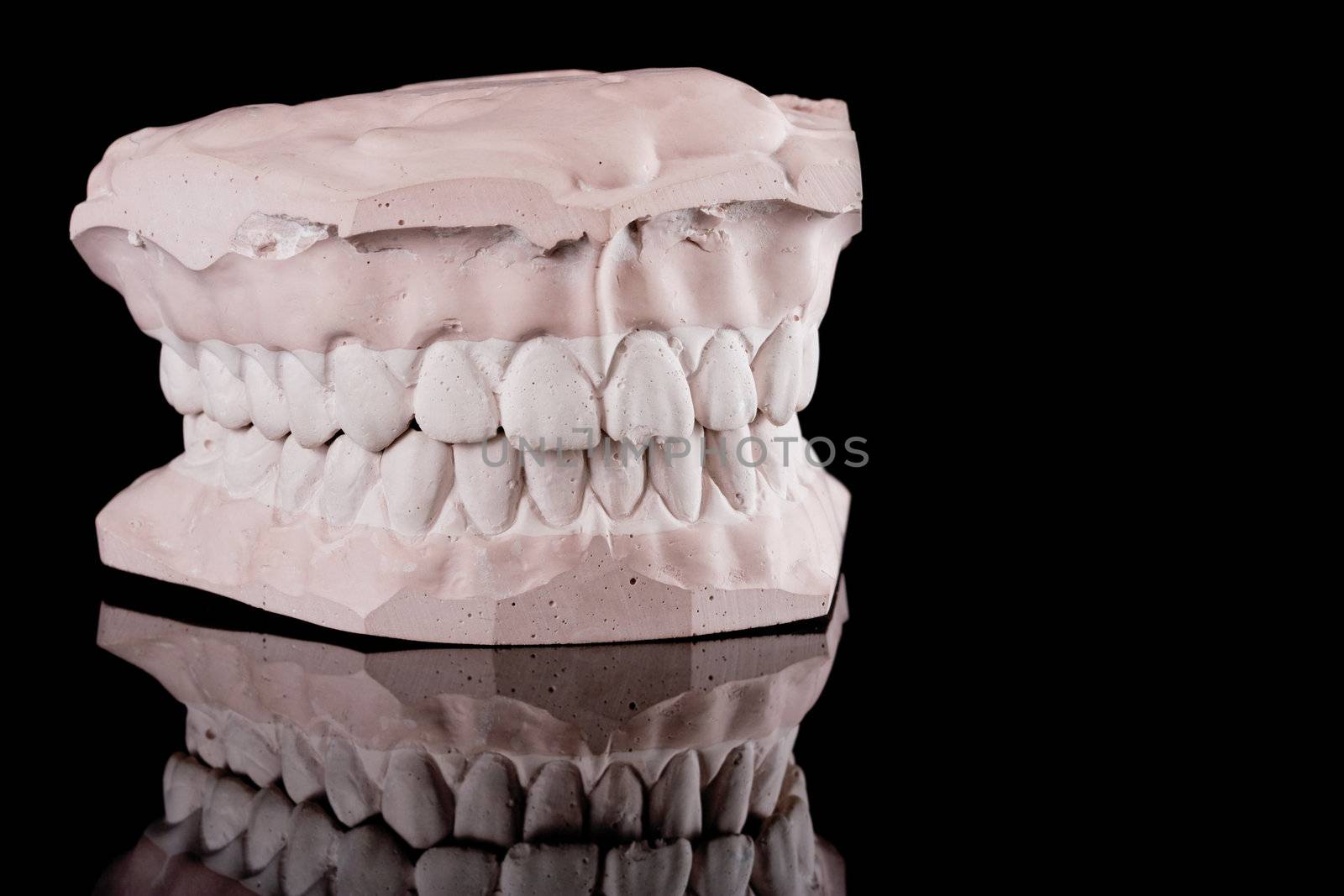 gypsum model of a human teeth on black background