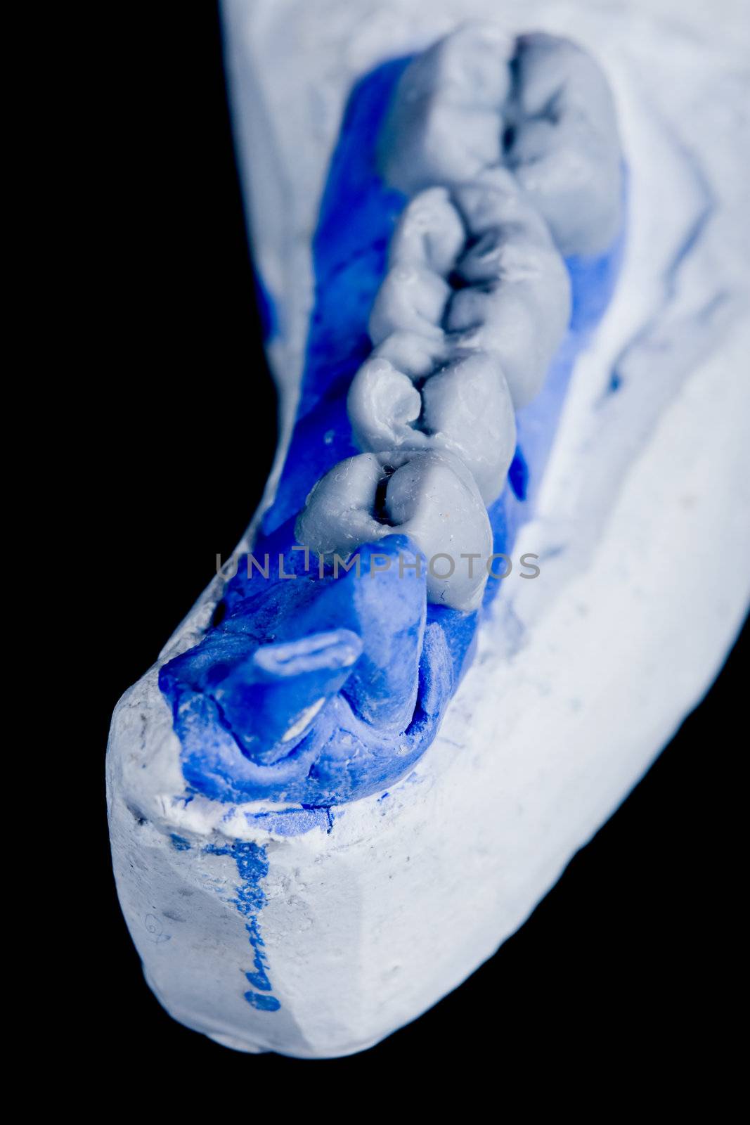 gypsum model of a human teeth on black background