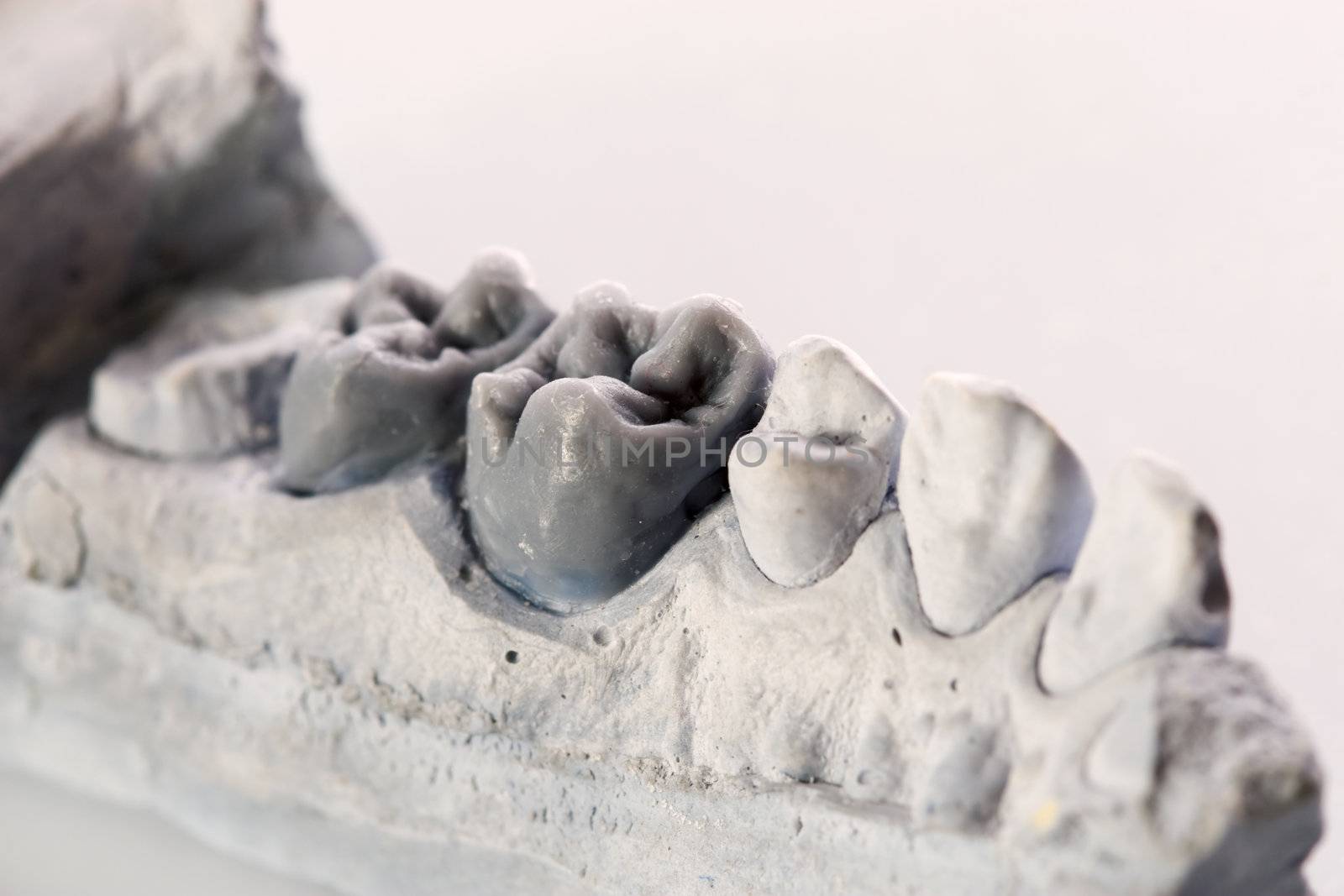 human teeth, model by kokimk