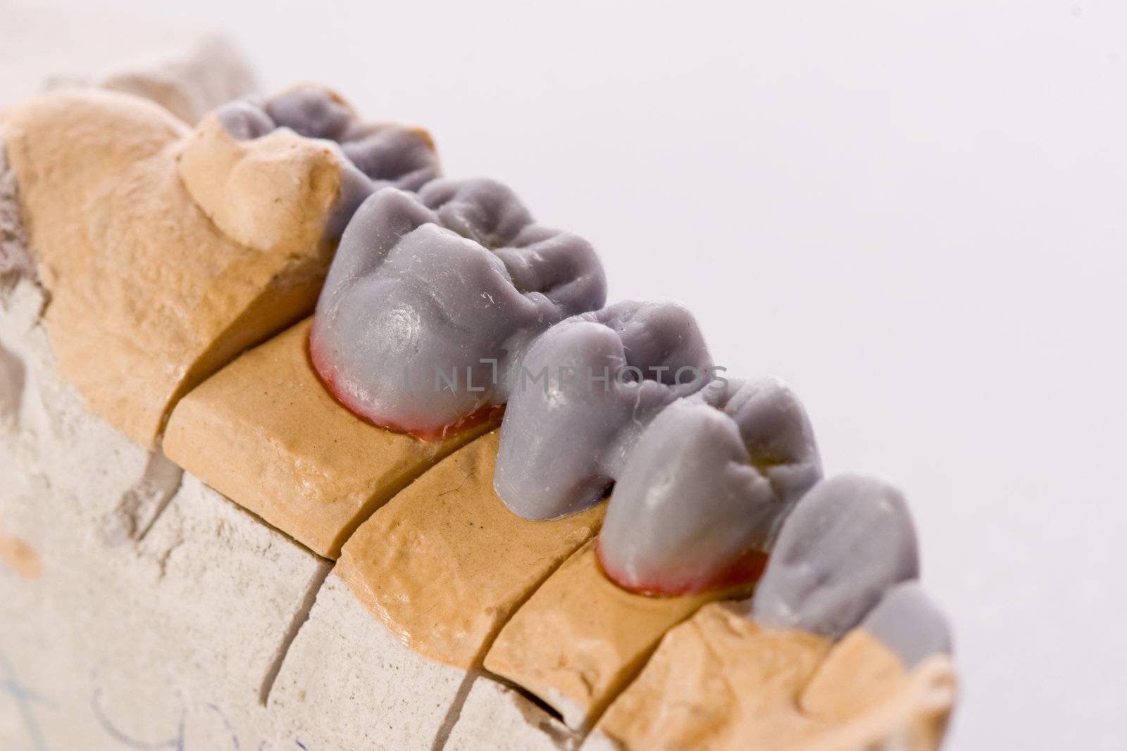gypsum model of a human teeth on white background