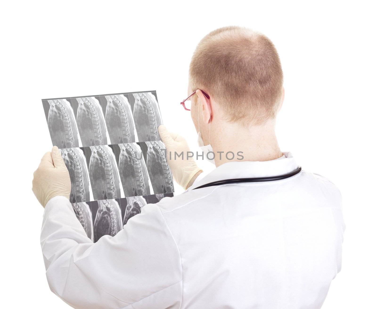 Medical doctor with radiograph