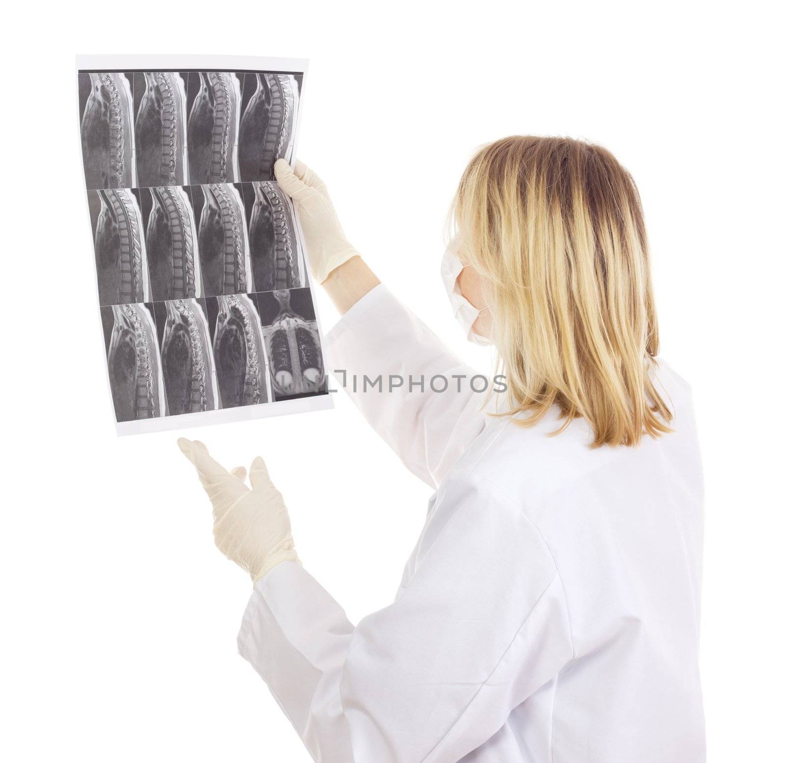 Medical doctor with radiograph