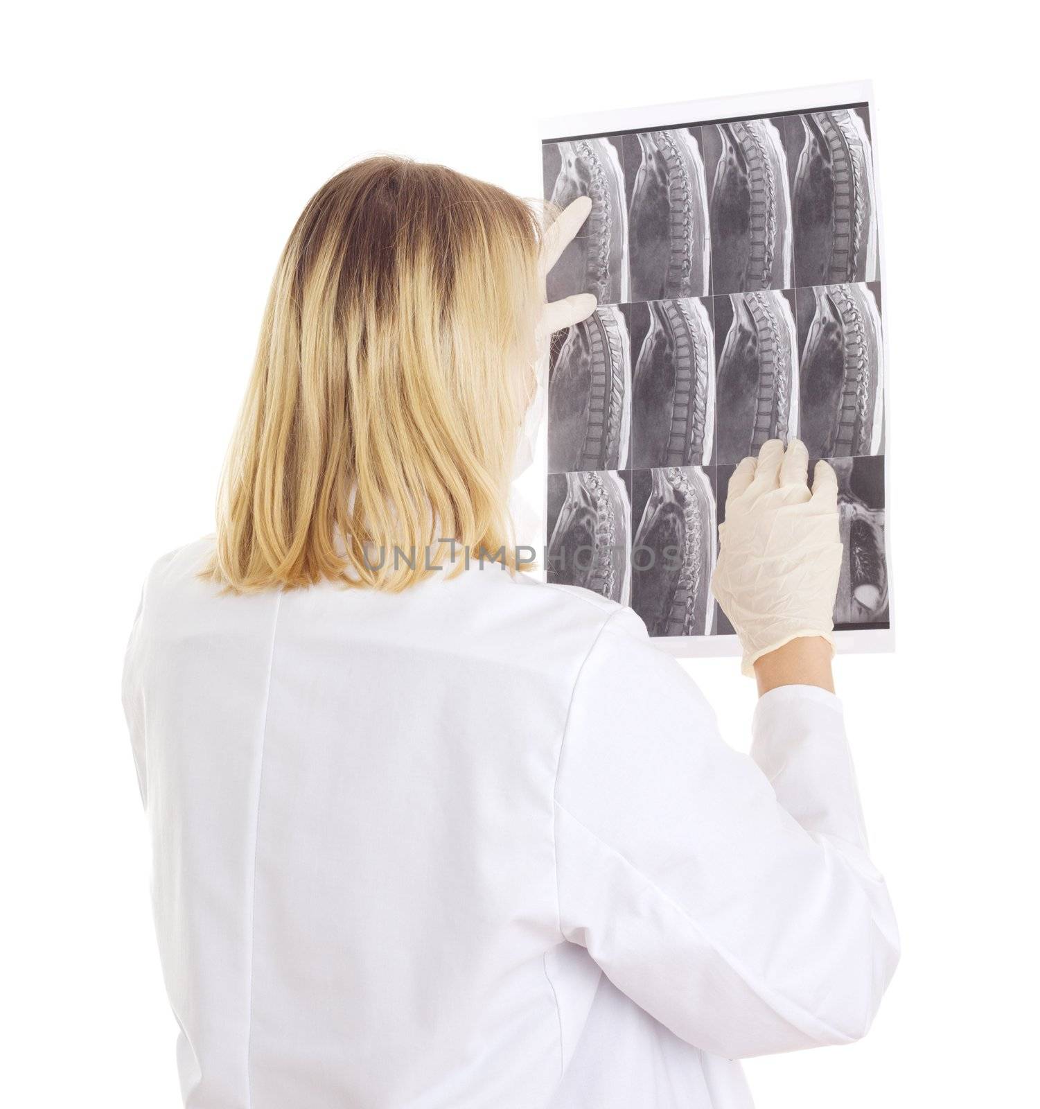 Medical doctor with radiograph
