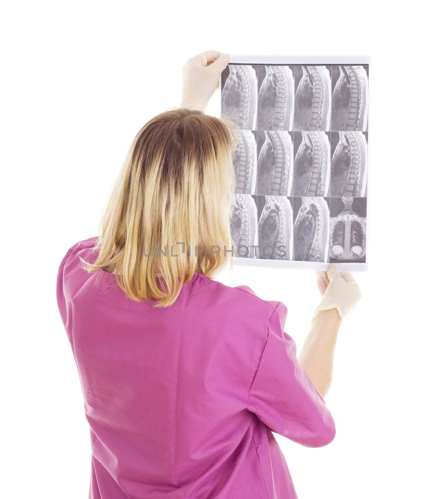 Medical doctor with radiograph