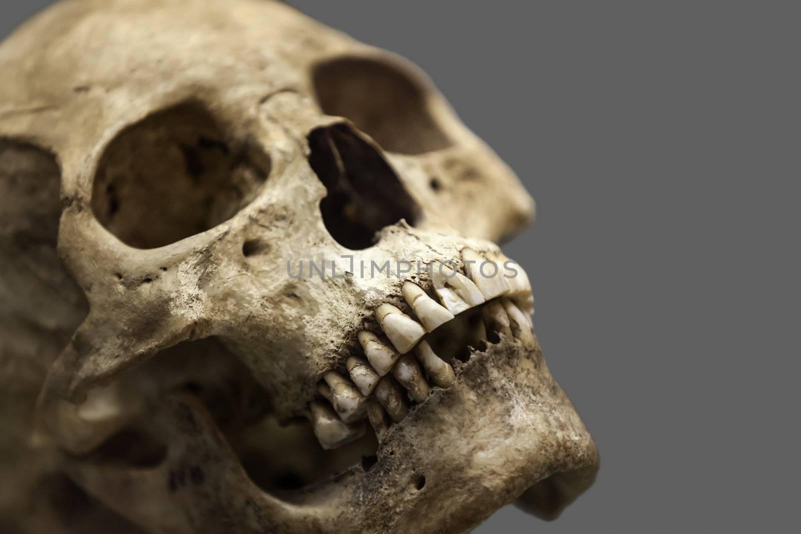 Human skull bone by ia_64