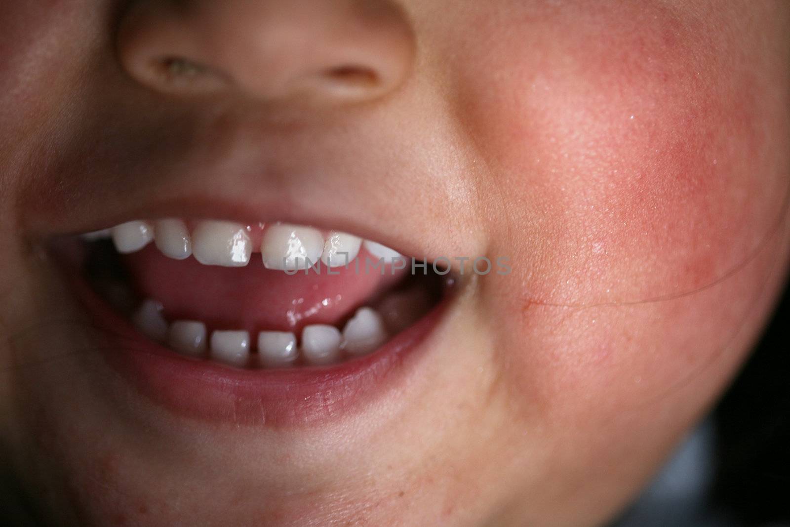  close up of child mouth while laughing