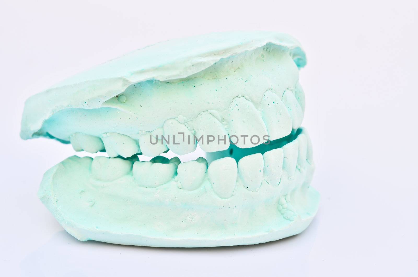 human teeth, model by raweenuttapong